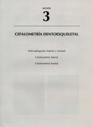 SECCIÓN
CEFALOMETRIA DENTOESQUELETAL
Telerradiografía (lateral y frontal)
Cefalometría lateral
Cefalometría frontal
 