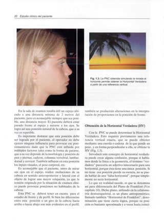 20 Estudio clínico del paciente
En la sala de examen resulta útil un espejo ubi-
cado a una distancia mínima de 2 metros del
paciente, pero es aconsejable siempre que sea posi-
ble, una distancia mayor. El paciente deberá estar
parado frente al espejo y mirarse a los ojos. Se
logra así una posición natural de la cabeza, que a su
vez es repetible.
Es impotante destacar que esta posición debe
ser lograda por el paciente, el operador no debe
ejercer ninguna influencia para provocar ese posi-
cionamiento dado que la PNC está influida por
múltiples factores tales como la forma de pararse,
que a su vez depende de la morfología y posición de
pies y piernas, caderas, columna vertebral, lumbar,
dorsal y cervical. También influyen en esta posición
los inputs visuales, el peso corporal, etc.
Es aconsejable que el paciente, antes de mirar
sus ojos en el espejo, realice oscilaciones de su
cabeza en sentido anteroposterior y lateral con el
objeto de lograr una mayor relajación, ya que la
tensión originada por la situación de examen clíni-
co puede provocar posiciones no habituales de la
cabeza. '
Esta PNC se deberá tener en cuenta para el
estudio de frente y de perfil. Si bien las diferencias
entre esta posición o un giro de la cabeza hacia
arriba o hacia abajo son más evidentes en el perfil,
Fig. 1.3: La PNC obtenida simulando la mirada al
horizonte permite obtener la Horizontal Verdadera
a partir de una referencia vertical.
también se producirán alteraciones en la interpre-
tación de proporciones en la posición de frente.
Obtención de la Horizontal Verdadera (HV)
Con la PNC se puede determinar la Horizontal
Verdadera. Esto requiere previamente una refe-
rencia vertical exacta, que se puede obtener
mediante una cuerda o cadena de la que pende un
peso , y en forma perpendicular a ella, se obtiene la
HV(Fig. 1.3).
Introducir este concepto de horizontal verdade-
ra puede crear alguna confusión, porque si habla-
mos desde la física o la geometría, el término "ver-
dadera" parecería un adjetivo innecesario para una
horizontal, porque ésta tiene una única posición. Si
no tiene esa posición pierde su esencia, no se pue-
de hablar de una "falsa horizontal", porque simple-
mente no sería horizontal.
Lo que en realidad sucede, es que se denomina
así para diferenciarla del Plano de Frankfort (Ver
capítulo 10). Dicho plano, utilizado en la cefalome-
tría dentoesqueletal, es un plano antropométrico,
llamado también "Horizontal de Frankfort", deno-
minación que tiene cierta lógica, porque su posi-
ción es bastante aproximada y a veces hasta coinci-
 