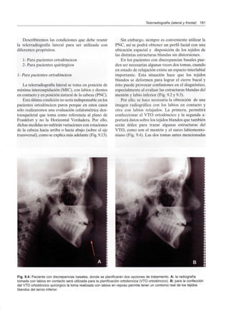 Telerradiografía (lateral y frontal) 181
Describiremos las condiciones que debe reunir
la telerradiografía lateral para ser utilizada con
diferentes propósitos.
1- Para pacientes ortodóncicos
2- Para pacientes quirúrgicos
1- Para pacientes ortodóncicos
La telerradiografía lateral se toma en posición de
máxima intercuspidación (MIC), con labios y dientes
en contacto y en posición natural de la cabeza (PNC).
Esta última condición no sería indispensable en los
pacientes ortodóncicos puros porque en estos casos
sólo realizaremosuna evaluación cefalométrica den-
toesqueletal que toma como referencia al plano de
Frankfort y no la Horizontal Verdadera. Por ello,
dichas medidasno sufrirán variaciones con rotaciones
de la cabeza hacia arriba o hacia abajo (sobre el eje
transversal), como se explica más adelante (Fig. 9.13).
Sin embargo, siempre es conveniente utilizar la
PNC, así se podrá obtener un perfil facial con una
ubicación espacial y disposición de los tejidos de
las distintas estructuras blandas sin distorsiones.
En los pacientes con discrepancias básales pue-
den ser necesarias algunas veces dos tomas, cuando
en estado de relajación exista un espacio interlabial
importante. Esta situación hace que los tejidos
blandos se deformen para lograr el cierre bucal y
ésto puede provocar confusiones en el diagnóstico,
especialmente al evaluar las estructuras blandas del
mentón y labio inferior (Fig. 9.2 y 9.3).
Por ello, se hace necesaria la obtención de una
imagen radiográfica con los labios en contacto y
otra con labios relajados. La primera, permitirá
confeccionar el VTO ortodóncico y la segunda a-
portará datos sobre los tejidos blandos que también
serán útiles para trazar algunas estructuras del
VTO, como son el mentón y el surco labiomento-
niano (Fig. 9.4). Las dos tomas antes mencionadas
Fig. 9.4: Paciente con discrepancias básales, donde se planificarán dos opciones de tratamiento. A: la radiografía
tomada con labios en contacto será utilizada para la planificación ortodoncica (VTO ortodóncico). B: para la confección
del VTO ortodóncico quirúrgico la toma realizada con labios en reposo permite tener un contorno real de los tejidos
blandos del tercio inferior.
 