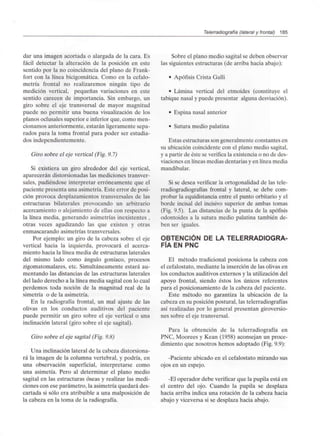 Telerradiografía (lateral y frontal) 185
dar una imagen acortada o alargada de la cara. Es
fácil detectar la alteración de la posición en este
sentido por la no coincidencia del plano de Frank-
fort con la línea bicigomática. Como en la cefalo-
metría frontal no realizaremos ningún tipo de
medición vertical, pequeñas variaciones en este
sentido carecen de importancia. Sin embargo, un
giro sobre el eje transversal de mayor magnitud
puede no permitir una buena visualización de los
planos oclusales superior e inferior que, como men-
cionamos anteriormente, estarán ligeramente sepa-
rados para la toma frontal para poder ser estudia-
dos independientemente.
Giro sobre el eje vertical (Fig. 9.7)
Si existiera un giro alrededor del eje vertical,
aparecerán distorsionadaslas mediciones transver-
sales, pudiéndose interpretar erróneamente que el
paciente presenta una asimetría. Este error de posi-
ción provoca desplazamientos transversales de las
estructuras bilaterales provocando un arbitrario
acercamiento o alejamiento de ellas con respecto a
la línea media, generando asimetrías inexistentes ,
otras veces agudizando las que existen y otras
enmascarando asimetrías transversales.
Por ejemplo: un giro de la cabeza sobre el eje
vertical hacia la izquierda, provocará el acerca-
miento hacia la línea media de estructuras laterales
del mismo lado como ángulo goníaco, procesos
zigomatomalares, etc. Simultáneamente estará au-
mentando las distancias de las estructuras laterales
del lado derecho a la línea media sagital con lo cual
perdemos toda noción de la magnitud real de la
simetría o de la asimetría.
En la radiografía frontal, un mal ajuste de las
olivas en los conductos auditivos del paciente
puede permitir un giro sobre el eje vertical o una
inclinación lateral (giro sobre el eje sagital).
Giro sobre el eje sagital (Fig. 9.8)
Una inclinación lateral de la cabeza distorsiona-
rá la imagen de la columna vertebral, y podría, en
una observación superficial, interpretarse como
una asimetía. Pero al determinar el plano medio
sagital en las estructuras óseas y realizar las medi-
ciones con ese parámetro, la asimetría quedará des-
cartada si sólo era atribuible a una malposición de
la cabeza en la toma de la radiografía.
Sobre el plano medio sagital se deben observar
las siguientes estructuras (de arriba hacia abajo):
• Apófisis Crista Galli
• Lámina vertical del etmoides (constituye el
tabique nasal y puede presentar algunadesviación).
• Espina nasal anterior
• Sutura medio palatina
Estas estructuras son generalmente constantes en
su ubicación coincidente con el plano medio sagital,
y a partir de éste se verifica la existencia o no de des-
viaciones en líneas medias dentarias y en línea media
mandibular.
Si se desea verificar la ortogonalidad de las tele-
rradiogradiografías frontal y lateral, se debe com-
probar la equidistancia entre el punto orbitario y el
borde incisal del incisivo superior de ambas tomas
(Fig. 9.5). Las distancias de la punta de la apófisis
odontoides a la sutura medio palatina también de-
ben ser iguales.
OBTENCIÓN DE LA TELERRADIOGRA-
FÍA EN PNC
El método tradicional posiciona la cabeza con
el cefalostato,mediante la inserción de las olivas en
los conductos auditivos externos y la utilización del
apoyo frontal, siendo éstos los únicos referentes
para el posicionamiento de la cabeza del paciente.
Este método no garantiza la ubicación de la
cabeza en su posición postural, las telerradiografías
así realizadas por lo general presentan giroversio-
nes sobre el eje transversal.
Para la obtención de la telerradiografía en
PNC, Moorees y Kean (1958) aconsejan un proce-
dimiento que nosotros hemos adoptado (Fig. 9.9):
-Paciente ubicado en el cefalostato mirando sus
ojos en un espejo.
-El operador debe verificar que la pupila está en
el centro del ojo. Cuando la pupila se desplaza
hacia arriba indica una rotación de la cabeza hacia
abajo y viceversa si se desplaza hacia abajo.
 