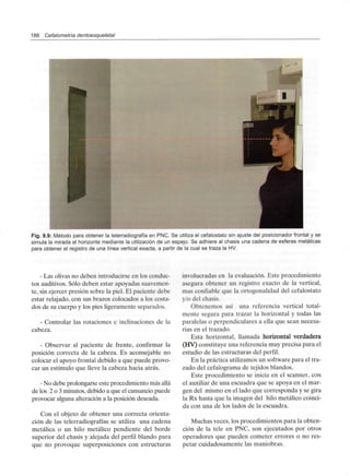 186 Cefalometría dentoesqueletal
Fig. 9.9: Método para obtener la telerradiografía en PNC. Se utiliza el cefalostato sin ajuste del posicionador frontal y se
simula la mirada al horizonte mediante la utilización de un espejo. Se adhiere al chasis una cadena de esferas metálicas
para obtener el registro de una línea vertical exacta, a partir de la cual se traza la HV.
- Las olivas no deben introducirse en los conduc-
tos auditivos. Sólo deben estar apoyadas suavemen-
te, sin ejercer presión sobre la piel. El paciente debe
estar relajado, con sus brazos colocados a los costa-
dos de su cuerpo y los pies ligeramente separados.
- Controlar las rotaciones e inclinaciones de la
cabeza.
- Observar al paciente de frente, confirmar la
posición correcta de la cabeza. Es aconsejable no
colocar el apoyo frontal debido a que puede provo-
car un estímulo que lleve la cabeza hacia atrás.
- No debe prolongarse este procedimiento más allá
de los 2 o 3 minutos, debido a que el cansancio puede
provocar alguna alteración a la posición deseada.
Con el objeto de obtener una correcta orienta-
ción de las telerradiografías se utiliza una cadena
metálica o un hilo metálico pendiente del borde
superior del chasis y alejada del perfil blando para
que no provoque superposiciones con estructuras
involucradas en la evaluación. Este procedimiento
asegura obtener un registro exacto de la vertical,
mas confiable que la ortogonalidad del cefalostato
y/o del chasis.
Obtenemos así una referencia vertical total-
mente segura para trazar la horizontal y todas las
paralelas o perpendiculares a ella que sean necesa-
rias en el trazado.
Esta horizontal, llamada horizontal verdadera
(HV) constituye una referencia muy precisa para el
estudio de las estructuras del perfil.
En la práctica utilizamos un software para el tra-
zado del cefalograma de tejidos blandos.
Este procedimiento se inicia en el scanner, con
el auxiliar de una escuadra que se apoya en el mar-
gen del mismo en el lado que corresponda y se gira
la Rx hasta que la imagen del hilo metálico coinci-
da con una de los lados de la escuadra.
Muchas veces, los procedimientos para la obten-
ción de la tele en PNC, son ejecutados por otros
operadores que pueden cometer errores o no res-
petar cuidadosamente las maniobras.
 