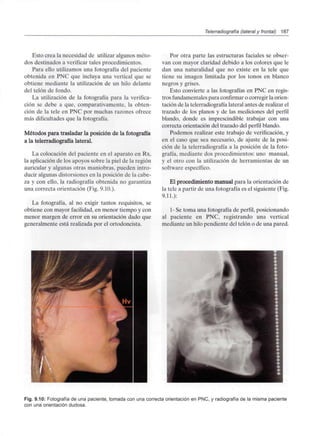 Telerradiografía (lateral y frontal) 187
Esto crea la necesidad de utilizar algunos méto-
dos destinados a verificar tales procedimientos.
Para ello utilizamos una fotografía del paciente
obtenida en PNC que incluya una vertical que se
obtiene mediante la utilización de un hilo delante
del telón de fondo.
La utilización de la fotografía para la verifica-
ción se debe a que, comparativamente, la obten-
ción de la tele en PNC por muchas razones ofrece
más dificultades que la fotografía.
Métodos para trasladar la posición de la fotografía
a la telerradiografía lateral.
La colocación del paciente en el aparato en Rx,
la aplicación de los apoyos sobre la piel de la región
auricular y algunas otras maniobras, pueden intro-
ducir algunas distorsiones en la posición de la cabe-
za y con ello, la radiografía obtenida no garantiza
una correcta orientación (Fig. 9.10.).
La fotografía, al no exigir tantos requisitos, se
obtiene con mayor facilidad, en menor tiempo y con
menor margen de error en su orientación dado que
generalmente está realizada por el ortodoncista.
Por otra parte las estructuras faciales se obser-
van con mayor claridad debido a los colores que le
dan una naturalidad que no existe en la tele que
tiene su imagen limitada por los tonos en blanco
negros y grises.
Esto convierte a las fotografías en PNC en regis-
tros fundamentales para confirmar o corregir la orien-
tación de la telerradiografía lateral antes de realizar el
trazado de los planos y de las mediciones del perfil
blando, donde es imprescindible trabajar con una
correcta orientación del trazado del perfil blando.
Podemos realizar este trabajo de verificación, y
en el caso que sea necesario, de ajuste de la posi-
ción de la telerradiografía a la posición de la foto-
grafía, mediante dos procedimientos: uno manual,
y el otro con la utilización de herramientas de un
software específico.
El procedimiento manual para la orientación de
la tele a partir de una fotografía es el siguiente (Fig.
9.11.):
1- Se toma una fotografía de perfil, posicionando
al paciente en PNC, registrando una vertical
mediante un hilo pendiente del telón o de una pared.
Fig. 9.10: Fotografía de una paciente, tomada con una correcta orientación en PNC, y radiografía de la misma paciente
con una orientación dudosa.
 