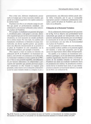 Telerradiografía (lateral y frontal) 191
Para evitar esto, debemos simplemente pensar
cuál es el campo que se hace necesario estudiar, que
puede ser el dentoesqueletal o los tejidos cutáneos y
la estética facial.
El primero de ellos es un reducido campo de aná-
lisis que puede ser perfectamente estudiado con
cefalometría convencional utilizando como referen-
cia el plano de Frankfort.
Por ejemplo, si estudiamos un paciente del grupo
1, ortodóncico puro, o del grupo 2, con una altera-
ción esqueletal que por ser leve será tratado sólo con
ortodoncia, no será necesario un estudio profundo
de la estética facial. Por otro lado, los cambios del
tratamiento ortodóncico se limitarán al campo den-
toalveolar, sin afectar aquellos puntos que pueden
tener una diferente interpretación de su posición si
el plano de Frankfort no está coincidente con la
Horizontal verdadera, por ejemplo: el mentón.
Otro aspecto a tener en cuenta en relación a la
utilización del Pl. de Frankfort o la horizontal ver-
dadera, está referido a la constancia en la ubicación.
La horizontal verdadera se traza a partir de la PNC,
que si bien es una posición repetible, está influencia-
da por factores inherentes a la subjetividad y per-
cepción del operador que pueden provocar peque-
ñas variaciones en ella. Cuando se requiere gran
precisión, como ocurre en la evaluación cefalométri-
ca de los casos tratados donde se compara el pre y
postratamiento, una diferencia mínima puede afec-
tar dicha evaluación, por lo que es aconsejable
superponer parcial o totalmente cefalometrías reali-
zadas a partir del plano de Frankfort, que es cons-
tante en su ubicación.
Utilización de la Horizontal Verdadera
En la cefalometría dentoesqueletal del paciente
de la Fig. 9.14 se observa una profundidad facial
aumentada que puede ser interpretada como una
posición adelantada del mentón; pero al corroborar
la orientación de la tele con la fotografía en PNC,
nos encontramos con una falta de horizontalidad
en el plano de Frankfort.
Si este paciente es tratado sólo con ortodoncia,
no se podrán realizar cambios en la posición sagital
del mentón, o serán muy pequeños, por lo que
carece de importancia clínica dicha interpretación.
En cambio, si se realizara un tratamiento orto-
dóncico-quirúrgico, en el cual deberemos planificar
cambios esqueletales, hacerlo en base a la interpre-
tación de las medidas tomadas en referencia al
Frankfort nos daría un resultado totalmente fuera
de parámetros de estética. Se planificaría errónea-
mente llevar el mentón hacia atrás, lo que desme-
joraría la relación cervical-facial inferior y la medi-
da del PoC a la vertical de Sn.
Fig. 9.14: Paciente con falta de horizontalidad del plano de Frankfort. La interpretación de medidas esqueleta-
les basadas en este plano, no concuerdan con las determinaciones basadas en el estudio estético del perfil.
 