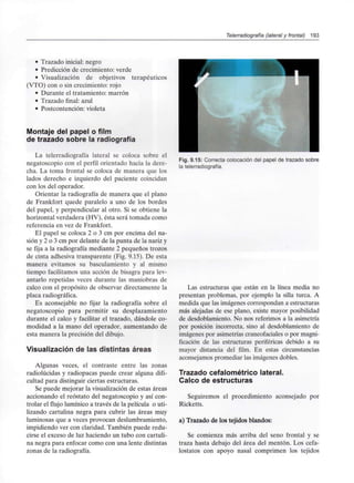 Telerradiografía (lateral y frontal) 193
• Trazado inicial: negro
• Predicción de crecimiento: verde
• Visualización de objetivos terapéuticos
(VTO) con o sin crecimiento: rojo
• Durante el tratamiento: marrón
• Trazado final: azul
• Postcontención: violeta
Montaje del papel o film
de trazado sobre la radiografía
La telerradiografía lateral se coloca sobre el
negatoscopio con el perfil orientado hacia la dere-
cha. La toma frontal se coloca de manera que los
lados derecho e izquierdo del paciente coincidan
con los del operador.
Orientar la radiografía de manera que el plano
de Frankfort quede paralelo a uno de los bordes
del papel, y perpendicular al otro. Si se obtiene la
horizontal verdadera (HV), ésta será tomada como
referencia en vez de Frankfort.
El papel se coloca 2 o 3 cm por encima del na-
sión y 2 o 3 cm por delante de la punta de la nariz y
se fija a la radiografía mediante 2 pequeños trozos
de cinta adhesiva transparente (Fig. 9.15). De esta
manera evitamos su basculamiento y al mismo
tiempo facilitamos una acción de bisagra para lev-
antarlo repetidas veces durante las maniobras de
calco con el propósito de observar directamente la
placa radiográfica.
Es aconsejable no fijar la radiografía sobre el
negatoscopio para permitir su desplazamiento
durante el calco y facilitar el trazado, dándole co-
modidad a la mano del operador, aumentando de
esta manera la precisión del dibujo.
Visualización de las distintas áreas
Algunas veces, el contraste entre las zonas
radiolúcidas y radiopacas puede crear alguna difi-
cultad para distinguir ciertas estructuras.
Se puede mejorar la Visualización de estas áreas
accionando el reóstato del negatoscopio y así con-
trolar el flujo lumínico a través de la película o uti-
lizando cartulina negra para cubrir las áreas muy
luminosas que a veces provocan deslumbramiento,
impidiendo ver con claridad. También puede redu-
cirse el exceso de luz haciendo un tubo con cartuli-
na negra para enfocar como con una lente distintas
zonas de la radiografía.
Fig. 9.15: Correcta colocación del papel de trazado sobre
la telerradiografía.
Las estructuras que están en la línea media no
presentan problemas, por ejemplo la silla turca. A
medida que las imágenes correspondan a estructuras
más alejadas de ese plano, existe mayor posibilidad
de desdoblamiento. No nos referimos a la asimetría
por posición incorrecta, sino al desdoblamiento de
imágenes por asimetrías craneofaciales o por magni-
ficación de las estructuras periféricas debido a su
mayor distancia del film. En estas circunstancias
aconsejamos promediar las imágenes dobles.
Trazado cefalométrico lateral.
Calco de estructuras
Seguiremos el procedimiento aconsejado por
Ricketts.
a) Trazado de los tejidos blandos:
Se comienza más arriba del seno frontal y se
traza hasta debajo del área del mentón. Los cefa-
lostatos con apoyo nasal comprimen los tejidos
 