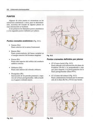 202 Cefalometría dentoesqueletal
PUNTOS
Algunos de estos puntos se encuentran en las
estructuras anatómicas y otros, para su determina-
ción, necesitan del trazado de algunos planos en
cuya intersección se localizan.
A los primeros los llamamos puntos anatómicos
y a los segundos punios definidos por planos.
Puntos craneales anatómicos (Fig. 10.1).
• Nasion (Na):
Punto anterior de la sutura frontonasal.
• Basion (Ba):
Punto posteroinferior del hueso occipital en
el margen anterior del foramen magnum.
• Porion (Pr):
Punto más superior del orificio del conducto
auditivo externo.
• Orbitario (Or):
Punto más inferior del reborde orbitario.
• Pterigoideo (Pt):
Intersección de las paredes posterior y supe-
rior de la fisura pterigomaxilar.Allí se locali-
za el agujero redondo mayor.
Fig. 10.2.
Puntos craneales definidos por planos
• CF (Centro facial) (Fig. 10.2):
Punto ubicado en la intersección del plano de
Frankfort (Pr-Or) y la perpendicular a éste
que pasa tangente a la pared posterior de la
fisura pterigomaxilar (línea PTV).
• CC (Centro del cráneo) (Fig. 10.3):
Punto cefalométricoformado por la intersec-
ción de la línea Ba-Na y Pt-Gn (eje facial).
Ba
Fig. 10.1. Fig. 10.3.
 