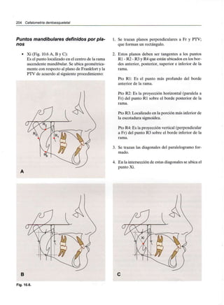 204 Cefalometría dentoesqueletal
Puntos mandibulares definidos por pla-
nos
• Xi (Fig. 10.6 A, B y C):
Es el punto localizado en el centro de la rama
ascendente mandibular. Se ubica geométrica-
mente con respecto al plano de Frankfort y la
PTV de acuerdo al siguiente procedimiento:
1. Se trazan planos perpendiculares a Fr y PTV;
que forman un rectángulo.
2. Estos planos deben ser tangentes a los puntos
Rl - R2 - R3 y R4 que están ubicados en los bor-
des anterior, posterior, superior e inferior de la
rama.
Pto Rl: Es el punto más profundo del borde
anterior de la rama.
Pto R2: Es la proyección horizontal (paralela a
Fr) del punto Rl sobre el borde posterior de la
rama.
Pto R3: Localizado en la porción más inferior de
la escotadura sigmoidea.
Pto R4: Es la proyección vertical (perpendicular
a Fr) del punto R3 sobre el borde inferior de la
rama.
3. Se trazan las diagonales del paralelogramo for-
mado.
4. En la intersección de estas diagonales se ubica el
punto Xi.
B
Fig. 10.6.
 