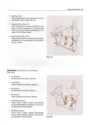 Cefalometría lateral 205
• De (Fig. 10.7):
Punto cefalométrico que representa el centro
del cóndilo sobre el plano Ba-Na.
• Gnation (Gn) (Fig. 10.7):
Punto formado por la intersección de la tan-
gente al punto mentoniano y al punto más
inferior de la rama (Plano mandibular) con el
plano Na-Po (Plano facial).
• Gonion (Go) (Fig. 10.7):
Punto formado por la intersección del plano
mandibular con una tangente al borde poste-
rior de la rama.
Fig. 10.7.
(Fig. 10.8)
(estos puntos son anatómicos)
Al Incisivo:
Borde incisal del incisivo superior.
Ar Incisivo:
Ápice radicular del incisivo superior.
Bl Incisivo:
Borde incisal del incisivo inferior.
Br Incisivo:
Ápice radicular del incisivo inferior.
A6 Molar superior:
Punto sobre el plano oclusal determinado
por una perpendicular tangente a la cara dis-
tal del primer molar superior.
B6 Molar inferior:
Punto sobre el plano oclusal determinado
por una perpendicular tangente a la cara dis-
tal del primer molar inferior. Fig. 10.8.
 