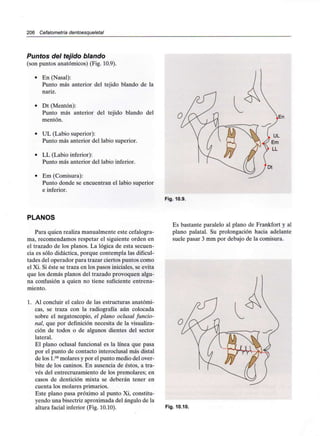 206 Cefalometría dentoesqueletal
Puntos del tejido blando
(son puntos anatómicos) (Fig. 10.9).
• En (Nasal):
Punto más anterior del tejido blando de la
nariz.
• Dt (Mentón):
Punto más anterior del tejido blando del
mentón.
• UL (Labio superior):
Punto más anterior del labio superior.
• LL (Labio inferior):
Punto más anterior del labio inferior.
• Em (Comisura):
Punto donde se encuentran el labio superior
e inferior.
Fig. 10.9.
PLANOS
Para quien realiza manualmente este cefalogra-
ma, recomendamos respetar el siguiente orden en
el trazado de los planos. La lógica de esta secuen-
cia es sólo didáctica, porque contempla las dificul-
tades del operador para trazar ciertos puntos como
el Xi. Si éste se traza en los pasos iniciales, se evita
que los demás planos del trazado provoquen algu-
na confusión a quien no tiene suficiente entrena-
miento.
1. Al concluir el calco de las estructuras anatómi-
cas, se traza con la radiografía aún colocada
sobre el negatoscopio, el plano oclusal funcio-
nal, que por definición necesita de la visualiza-
ción de todos o de algunos dientes del sector
lateral.
El plano oclusal funcional es la línea que pasa
por el punto de contacto interoclusal más distal
de los l.os molares y por el punto medio del over-
bite de los caninos. En ausencia de éstos, a tra-
vés del entrecruzamiento de los premolares; en
casos de dentición mixta se deberán tener en
cuenta los molares primarios.
Este plano pasa próximo al punto Xi, constitu-
yendo una bisectriz aproximada del ángulo de la
altura facial inferior (Fig. 10.10).
Es bastante paralelo al plano de Frankfort y al
plano palatal. Su prolongación hacia adelante
suele pasar 3 mm por debajo de la comisura.
Fig. 10.10.
 