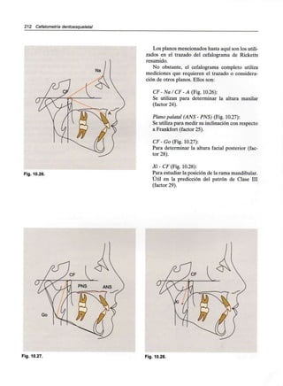 212 Cefalometría dentoesqueletal
Fig. 10.26.
Los planos mencionados hasta aquí son losutili-
zados en el trazado del cefalograma de Ricketts
resumido.
No obstante, el cefalograma completo utiliza
mediciones que requieren el trazado o considera-
ción de otros planos. Ellos son:
CF-Na/CF-A (Fig. 10.26):
Se utilizan para determinar la altura maxilar
(factor 24).
Plano palatal (ANS - PNS) (Fig. 10.27):
Se utiliza para medir su inclinación con respecto
a Frankfort (factor 25).
CF - Go (Fig. 10.27):
Para determinar la altura facial posterior (fac-
tor 28).
Xi-CF (Fig. 10.28):
Para estudiar la posición de la rama mandibular.
Útil en la predicción del patrón de Clase III
(factor 29).
Go
Fig. 10.27. Fig. 10.28.
 