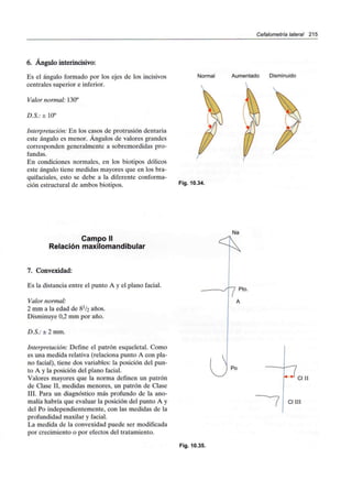 Cefalometría lateral 215
6. Ángulo interincisivo:
Es el ángulo formado por los ejes de los incisivos
centrales superior e inferior.
Valor normal: 130°
D.S.: ± 10°
Interpretación: En los casos de protrusión dentaria
este ángulo es menor. Ángulos de valores grandes
corresponden generalmente a sobremordidas pro-
fundas.
En condiciones normales, en los biotipos dólicos
este ángulo tiene medidas mayores que en los bra-
quifaciales, esto se debe a la diferente conforma-
ción estructural de ambos biotipos.
Normal Aumentado Disminuido
Fig. 10.34.
Campo II
Relación maxilomandibular
7. Convexidad:
Es la distancia entre el punto A y el plano facial.
Valor normal:
2 mm a la edad de 8^/2 años.
Disminuye 0,2 mm por año.
D.S.: ± 2 mm.
Interpretación: Define el patrón esqueletal. Como
es una medida relativa (relaciona punto A con pla-
no facial), tiene dos variables: la posición del pun-
to A y la posición del plano facial.
Valores mayores que la norma definen un patrón
de Clase II, medidas menores, un patrón de Clase
III. Para un diagnóstico más profundo de la ano-
malía habría que evaluar la posición del punto A y
del Po independientemente, con las medidas de la
profundidad maxilar y facial.
La medida de la convexidad puede ser modificada
por crecimiento o por efectos del tratamiento.
Na
Pto.
Po
Cl II
CIIII
Fig. 10.35.
 