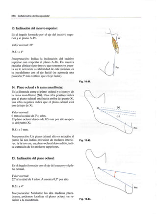 218 Cefalometría dentoesqueletal
13.Inclinación del incisivo superior:
Es el ángulo formado por el eje del incisivo supe-
rior y el plano A-Po.
Valor normal: 28°
D.S.: ± 4°
Interpretación: Indica la inclinación del incisivo
superior con respecto al plano A-Po. En nuestra
práctica clínica el parámetro que tenemos en cuen-
ta en lo referente a estabilidad de este incisivo, es
su paralelismo con el eje facial (se aconseja una
posición 5° más vertical que el eje facial).
14. Plano oclusal a la rama mandibular:
Es la distancia entre el plano oclusal y el centro de
la rama mandibular (Xi). Una cifra positiva indica
que el plano oclusal está hacia arriba del punto Xi,
una cifra negativa indica que el plano oclusal está
por debajo de Xi.
Valor normal:
O mm a la edad de 91/2 años.
El plano oclusal desciende 0,5 mm por año respec-
to del punto Xi.
D.S.: ± 3 mm.
Interpretación: Un plano oclusal alto en relación al
punto Xi nos indica extrusión de molares inferio-
res. A la inversa,un plano oclusal descendido, indi-
ca extrusión de los molares superiores.
15. Inclinación del plano oclusal:
Es el ángulo formado por el eje del cuerpo y el pla-
no oclusal.
Valor normal:
22° a la edad de 8 años. Aumenta 0,5° por año.
D.S.: ± 4°
Interpretación: Mediante las dos medidas prece-
dentes, podemos localizar el plano oclusal en re-
lación a la mandíbula.
Po
Fig. 10.41.
Fig. 10.42.
Fig. 10.43.
 
