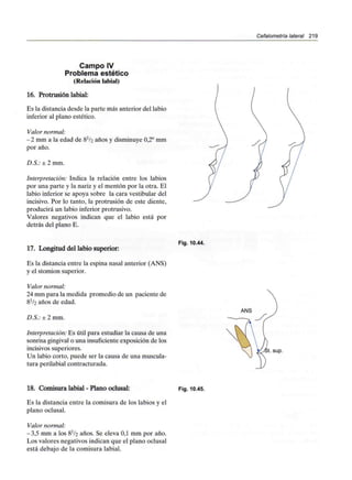 Cefalometría lateral 219
Campo IV
Problema estético
(Relación labial)
16. Protrusión labial:
Es la distancia desde la parte más anterior del labio
inferior al plano estético.
Valor normal:
- 2 mm a la edad de 8^2 años y disminuye 0,2° mm
por año.
D.S.: ± 2 mm.
Interpretación: Indica la relación entre los labios
por una parte y la nariz y el mentón por la otra. El
labio inferior se apoya sobre la cara vestibular del
incisivo. Por lo tanto, la protrusión de este diente,
producirá un labio inferiorprotrusivo.
Valores negativos indican que el labio está por
detrás del plano E.
17. Longitud del labio superior:
Es la distancia entre la espina nasal anterior (ANS)
y el stomion superior.
Valor normal:
24 mm para la medida promedio de un paciente de
8^/2 años de edad.
D.S.: ± 2 mm.
Interpretación: Es útil para estudiar la causa de una
sonrisa gingivalo una insuficienteexposición de los
incisivos superiores.
Un labio corto, puede ser la causa de una muscula-
tura perilabial contracturada.
Fig. 10.44.
sup.
18. Comisura labial - Plano oclusal:
Es la distancia entre la comisura de los labios y el
plano oclusal.
Valor normal:
-3,5 mm a los 8^/2 años. Se eleva 0,1 mm por año.
Los valores negativos indican que el plano oclusal
está debajo de la comisura labial.
Fig. 10.45.
 