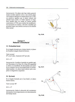 220 Cefalometría dentoesqueletal
Interpretación: Un plano más bajo indica general-
mente un labio superior corto y una sonrisa gingi-
val.Cuando la distancia se inclina hacia cero o valo-
res positivos significa que el plano oclusal está
ubicado hacia arriba o el labio superior es largo.
Esta medida debe ser tenida en cuenta cuando
construimos el VTO, para realizar las modificacio-
nes necesarias en el plano, y llevarlo a medidas que
permitan lograr una estética correcta en la relación
labio-incisal.
Fig. 10.46.
Campo V
Relación craneofacial
19. Profundidad facial:
Es el ángulo formado por el plano facial y el plano
de Frankfort (ángulo facial de Downs).
Valor normal:
87° a los 9 años. Aumenta 0,33° por año.
D.S.: ± 3°
Interpretación: Localiza el mentón en sentido sagi-
tal. Determina si la Clase II o Clase III esqueletal
se deben a la mandíbula. Es útil estudiar esta medi-
da en conjunto con la convexidad facial, la profun-
didad maxilar y la altura facial inferior para com-
pletar el diagnóstico esqueletal.
20. Eje facial:
Es el ángulo formado por el eje facial y el plano
basion-nasion.
Valor normal: 90°
D.S.: ± 3°
Interpretación: Indica la dirección del crecimiento
del mentón. Es de importancia en la determinación
del biotipo facial.
Pl. Fr.
Fig. 10.47.
Ba
Fig. 10.48.
 