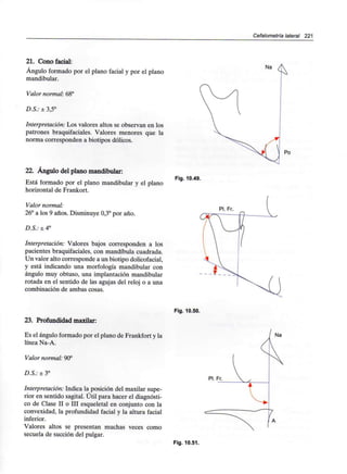 Cefalometría lateral 221
21. Cono facial:
Ángulo formado por el plano facial y por el plano
mandibular.
Valor normal: 68°
D.S.: ± 3,5°
Interpretación: Los valores altos se observan en los
patrones braquifaciales. Valores menores que la
norma corresponden a biotipos dólicos.
22. Ángulo del plano mandibular:
Está formado por el plano mandibular y el plano
horizontal de Frankort.
Valor normal:
26° a los 9 años. Disminuye 0,3° por año.
D.S.: ± 4°
Interpretación: Valores bajos corresponden a los
pacientes braquifaciales, con mandíbula cuadrada.
Un valor alto corresponde a un biotipo dolicofacial,
y está indicando una morfología mandibular con
ángulo muy obtuso, una implantación mandibular
rotada en el sentido de las agujas del reloj o a una
combinación de ambas cosas.
Na
Fig. 10.49.
Fig. 10.50.
23. Profundidad maxilar:
Es el ángulo formadopor el plano de Frankforty la
línea Na-A.
Valor normal: 90°
D.S.: ± 3°
Interpretación: Indica la posición del maxilar supe-
rior en sentido sagital. Útil para hacer el diagnósti-
co de Clase II o III esqueletal en conjunto con la
convexidad, la profundidad facial y la altura facial
inferior.
Valores altos se presentan muchas veces como
secuela de succión del pulgar.
Pl. Fr.
Fig. 10.51.
 