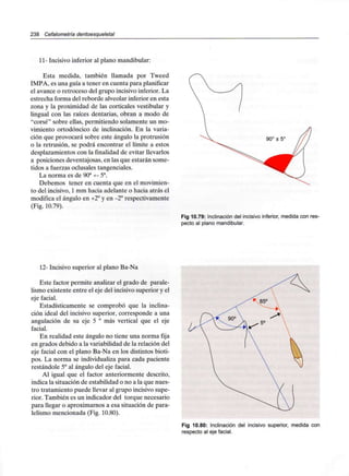 238 Cefalometría dentoesqueletal
11- Incisivo inferior al plano mandibular:
Esta medida, también llamada por Tweed
IMPA, es una guía a tener en cuenta para planificar
el avance o retroceso del grupo incisivo inferior. La
estrecha forma del reborde alveolar inferior en esta
zona y la proximidad de las corticales vestibular y
lingual con las raíces dentarias, obran a modo de
"corsé" sobre ellas, permitiendo solamente un mo-
vimiento ortodóncico de inclinación. En la varia-
ción que provocará sobre este ángulo la protrusión
o la retrusión, se podrá encontrar el límite a estos
desplazamientos con la finalidad de evitar llevarlos
a posiciones deventajosas, en las que estarán some-
tidos a fuerzas oclusales tangenciales.
La norma es de 90a +- 5a.
Debemos tener en cuenta que en el movimien-
to del incisivo, 1mm hacia adelante o hacia atrás el
modifica el ángulo en +2° y en -2° respectivamente
(Fig. 10.79).
Fig 10.79: Inclinación del incisivo inferior, medida con res-
pecto al plano mandibular.
12- Incisivo superior al plano Ba-Na
Este factor permite analizar el grado de parale-
lismo existente entre el eje del incisivo superior y el
eje facial.
Estadísticamente se comprobó que la inclina-
ción ideal del incisivo superior, corresponde a una
angulación de su eje 5 ° más vertical que el eje
facial.
En realidad este ángulo no tiene una norma fija
en grados debido a la variabilidad de la relación del
eje facial con el plano Ba-Na en los distintos bioti-
pos. La norma se individualiza para cada paciente
restándole 5° al ángulo del eje facial.
Al igual que el factor anteriormente descrito,
indica la situación de estabilidad o no a la que nues-
tro tratamiento puede llevar al grupo incisivo supe-
rior. También es un indicador del torque necesario
para llegar o aproximarnos a esa situación de para-
lelismo mencionada (Fig. 10.80).
Fig 10.80: Inclinación del incisivo superior, medida con
respecto al eje facial.
 