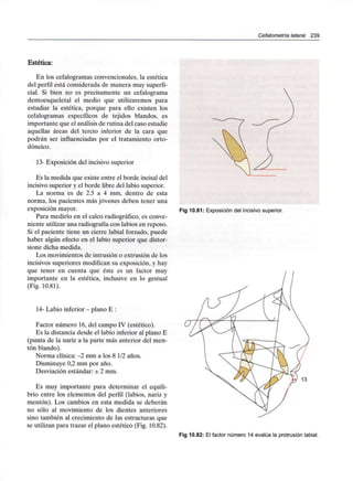 Cefalometría lateral 239
Estética:
En los cefalogramas convencionales, la estética
del perfil está considerada de manera muy superfi-
cial. Si bien no es precisamente un cefalograma
dentoesqueletal el medio que utilizaremos para
estudiar la estética, porque para ello existen los
cefalogramas específicos de tejidos blandos, es
importante que el análisis de rutina del caso estudie
aquellas áreas del tercio inferior de la cara que
podrán ser influenciadas por el tratamiento orto-
dóncico.
13- Exposición del incisivo superior
Es la medida que existe entre el borde incisal del
incisivo superior y el borde libre del labio superior.
La norma es de 2.5 a 4 mm, dentro de esta
norma, los pacientes más jóvenes deben tener una
exposición mayor.
Para medirlo en el calco radiográfico, es conve-
niente utilizar una radiografía con labios en reposo.
Si el paciente tiene un cierre labial forzado, puede
haber algún efecto en el labio superior que distor-
sione dicha medida.
Los movimientos de intrusión o extrusiónde los
incisivos superiores modifican su exposición, y hay
que tener en cuenta que éste es un factor muy
importante en la estética, inclusive en lo gestual
(Fig. 10.81).
14- Labio inferior - plano E :
Factor número 16, del campo IV (estético).
Es la distancia desde el labio inferior al plano E
(punta de la nariz a la parte más anterior del men-
tón blando).
Norma clínica: -2 mm a los 8 1/2 años.
Disminuye 0,2 mm por año.
Desviación estándar: + 2 mm.
Es muy importante para determinar el equili-
brio entre los elementos del perfil (labios, nariz y
mentón). Los cambios en esta medida se deberán
no sólo al movimiento de los dientes anteriores
sino también al crecimiento de las estructuras que
se utilizan para trazar el plano estético (Fig. 10.82).
Fig 10.81: Exposición del incisivo superior.
13
Fig 10.82: El factor número 14 evalúa la protrusión labial.
 