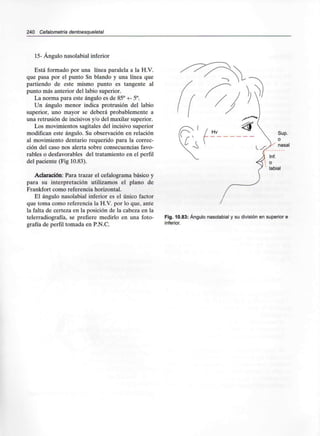 240 Cefalometría dentoesqueletal
15- Ángulo nasolabial inferior
Está formado por una línea paralela a la H.V.
que pasa por el punto Sn blando y una línea que
partiendo de este mismo punto es tangente al
punto más anterior del labio superior.
La norma para este ángulo es de 85° +-5°.
Un ángulo menor indica protrusión del labio
superior, uno mayor se deberá probablemente a
una retrusión de incisivos y/o del maxilar superior.
Los movimientos sagitales del incisivo superior
modifican este ángulo. Su observación en relación
al movimiento dentario requerido para la correc-
ción del caso nos alerta sobre consecuencias favo-
rables o desfavorables del tratamiento en el perfil
del paciente (Fig 10.83).
Aclaración: Para trazar el cefalograma básico y
para su interpretación utilizamos el plano de
Frankfort como referencia horizontal.
El ángulo nasolabial inferior es el único factor
que toma como referencia la H.V. por lo que. ante
la falta de certeza en la posición de la cabeza en la
telerradiografía, se prefiere medirlo en una foto-
grafía de perfil tomada en P.N.C.
Fig. 10.83: Ángulo nasolabial y su división en superior e
inferior.
 