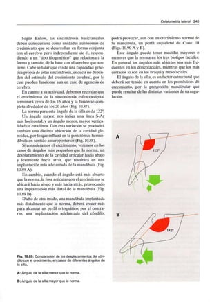 Cefalometría lateral 245
Según Enlow, las sincondrosis basicraneales
deben considerarse como unidades autónomas de
crecimiento que se desarrollan en forma conjunta
con el cerebro pero independiente de él, respon-
diendo a un "tipo filogenético" que relacionará la
forma y tamaño de la base con el cerebro que sos-
tiene. Cabe señalar que existe una capacidad gené-
tica propia de estas sincondrosis, es decir no depen-
den del estímulo del crecimiento cerebral, por lo
cual pueden funcionar aun en caso de agenesia de
cerebro.
En cuanto a su actividad, debemos recordar que
el crecimiento de la sincondrosis esfenooccipital
terminará cerca de los 15 años y la fusión se com-
pleta alrededor de los 20 años (Fig. 10.87).
La norma para este ángulo de la silla es de 122°.
Un ángulo mayor, nos indica una línea S-Ar
más horizontal; y un ángulo menor, mayor vertica-
lidad de esta línea. Con esta variación se producirá
también una distinta ubicación de la cavidad gle-
noidea, por lo que influirá en la posición de la man-
díbula en sentido anteroposterior (Fig. 10.88).
Si consideramos el crecimiento, veremos en los
casos de ángulos más pequeños que la norma, un
desplazamiento de la cavidad articular hacia abajo
y levemente hacia atrás, que resultará en una
implantación más adelantada de la mandíbula (Fig.
10.89 A).
En cambio, cuando el ángulo está más abierto
que la norma, la fosa articular con el crecimiento se
ubicará hacia abajo y más hacia atrás, provocando
una implantación más distal de la mandíbula (Fig.
10.89 B).
Dicho de otro modo, una mandíbula implantada
más distalmente que la norma, deberá crecer más
para alcanzar un perfil ortognático; por el contra-
rio, una implantación adelantada del cóndilo,
Fig. 10.89: Comparación de los desplazamientos del cón-
dilo con el crecimiento, en casos de diferentes ángulos de
la silla.
A: Ángulo de la silla menor que la norma.
B: Ángulo de la silla mayor que la norma.
podrá provocar, aun con un crecimiento normal de
la mandíbula, un perfil esqueletal de Clase III
(Figs. 10.90 A y B).
Este ángulo puede tener medidas mayores o
menores que la norma en los tres biotipos faciales.
En general los ángulos más abiertos son más fre-
cuentes en los dolicofaciales, mientras que los más
cerrados lo son en los braqui y mesofaciales.
El ángulo de la silla, es un factor estructural que
deberá ser tenido en cuenta en los pronósticos de
crecimiento, por la proyección mandibular que
puede resultar de las distintas variantes de su angu-
lación.
B
• -
 
