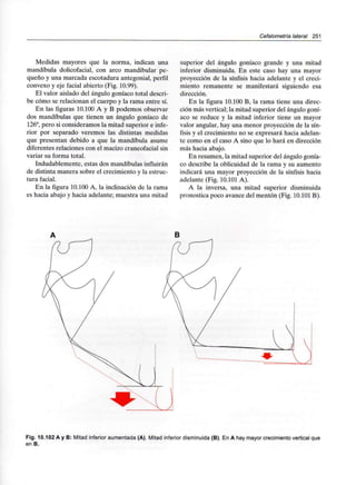 Cefalometría lateral 251
Medidas mayores que la norma, indican una
mandíbula dolicofacial, con arco mandibular pe-
queño y una marcada escotadura antegonial, perfil
convexo y eje facial abierto (Fig. 10.99).
El valor aislado del ángulo goníaco totaldescri-
be cómo se relacionan el cuerpo y la rama entre sí.
En las figuras 10.100 A y B podemos observar
dos mandíbulas que tienen un ángulo goníaco de
126°, pero si consideramos la mitad superior e infe-
rior por separado veremos las distintas medidas
que presentan debido a que la mandíbula asume
diferentes relaciones con el macizo craneofacialsin
variar su forma total.
Indudablemente, estas dos mandíbulas influirán
de distinta manera sobre el crecimiento y la estruc-
tura facial.
En la figura 10.100 A, la inclinación de la rama
es hacia abajo y hacia adelante; muestra una mitad
superior del ángulo goníaco grande y una mitad
inferior disminuida. En este caso hay una mayor
proyección de la sínfisis hacia adelante y el creci-
miento remanente se manifestará siguiendo esa
dirección.
En la figura 10.100 B, la rama tiene una direc-
ción más vertical; la mitad superior del ángulo goní-
aco se reduce y la mitad inferior tiene un mayor
valor angular, hay una menor proyección de la sín-
fisis y el crecimiento no se expresará hacia adelan-
te como en el caso A sino que lo hará en dirección
más hacia abajo.
En resumen, la mitad superior del ángulo gonía-
co describe la oblicuidad de la rama y su aumento
indicará una mayor proyección de la sínfisis hacia
adelante (Fig. 10.101 A).
A la inversa, una mitad superior disminuida
pronostica poco avance del mentón (Fig. 10.101 B).
Fig. 10.102 A y B: Mitad inferior aumentada (A). Mitad inferior disminuida (B). En A hay mayor crecimiento vertical que
en B.
 