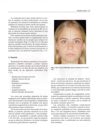 Estética facial 27
La evaluación de la línea media inferior serea-
liza en relación a la línea media facial y en el caso
de pacientes con asimetría mandibular se evaluará
también en relación al punto medio del mentón.
Debemos recordar que estas observaciones se
realizan con la mandíbula en posición de RC por lo
que se descarta cualquier factor funcional en una
desviación de la línea media inferior.
Este examen de las líneas medias dentarias refe-
rido a la línea media facial se complementa con un
minucioso estudio de las arcadas por oclusal (ver
estudio bucodental, Pag. 73 y Fig 2.15A y B) para
detectar posibles desviaciones de origen dentario.
Estas desviaciones que se deben frecuentemente a
la falta unilateral de piezas, pueden presentarse en
pacientes con o sin asimetría esqueletal (Fig.1.11).
4- Simetría
Respetando los mismos parámetros de posicio-
namiento (cóndilos centrados y primer contacto
dentario), el examen consiste en la observación de
la equidistancia o la falta de ella con respecto a la
línea media, de las siguientes estructuras (Fig.
1.12):
- Eminencias frontales laterales
- Ángulo externo del ojo
- Pómulos
- Pabellones auriculares
- Alas nasales
- Comisuras.
- Ángulos goníacos
- Puntos laterales del mentón
Los casos que presenten asimetrías de escasa
magnitud crean algunas dificultades para su detec-
ción. Recurriremos a las fotografías ycefalometrías
frontales con el propósito de analizar con mayor
exactitud la magnitud de la alteración, ya que sobre
ellas podemos hacer mediciones.
En las laterodesviaciones funcionales de la man-
díbula, el paciente presenta asimetría en su posi-
ción de máxima intercuspidación, y ésta desapare-
ce al llevar la mandíbula a relación céntrica (Fig.
1.13). Por ello, en esta posición, todas las asimetrí-
as que se observen obedecen a un factor etiológico
estructural, generalmente esqueletal.
Fig. 1.12: Puntos bilaterales para el estudio de la sime-
tría.
Las asimetrías se estudian de manera "ascen-
dente", siendo las más leves las que involucran la
forma del mentón solamente, siguiendo las origina-
das por asimetrías en el cuerpo y la rama de la man-
díbula, que comprometen el contorno facial lateral,
y si son marcadas, pueden llegar a desviar la comi-
sura labial.
Aumentando el grado de complejidad, encon-
tramos las asimetrías máxilo-mandibulares (involu-
cran mandíbula y maxilar superior). Éstas podrán
ser mejor evaluadas en sonrisa, con el estudio de
los planos oclusales (punto 6).
Las asimetrías más complejas comprometen
también las órbitas y el contorno craneal en diver-
sa magnitud, pudiendo ser leves, apenas percepti-
bles, o de una magnitud mayor, tratándose estos
casos generalmente de microsomías hemifaciales.
Existen también asimetrías en la forma nasal,
desviaciones del dorso y de la punta, que pueden
presentarse solas o combinadas con una asimetría
más compleja.
 