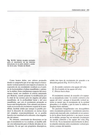 Cefalometría lateral 259
Fig. 10.113: Valores anuales promedio
para el crecimiento de las distintas
estructuras en la parte anterior y poste-
rior de la cara. Tomado de Stóckli.
2,6 mm/á
Como hemos dicho, son valores promedio
donde se comprueba que al ser algo mayor el incre-
mento vertical posterior con respecto al anterior, la
expresión de ese crecimiento resultará en el senti-
do de horizontalizar el plano mandibular y adelan-
tar la sínfisis. Estas conclusiones respecto del creci-
miento facial, son similares al criterio sustentado
por Ricketts, cuando propone la modificación por
la edad de las normas para los ángulos del plano
mandibular, de la profundidad facial y del arco
mandibular, que con el crecimiento promedio se
hacen más braquifaciales.Esto además está demos-
trado en su teoría de crecimiento arquial de la man-
díbula. Jarabak señala que aunque es posible pre-
decir la dirección de crecimiento en ciertas áreas
del complejo craneomaxilofacial, no es posible
hacerlo con exactitud en lo referente a las magnitu-
des del mismo.
No obstante, conociendo las direcciones en las
que el crecimiento se va a realizar, es factible utili-
zar esta información para el diseño del plan de tra-
tamiento. Es así que con propósitos descriptivos,
señala tres tipos de crecimiento de acuerdo a su
dirección general (Fig. 10.114 A, B y C).
A. En sentido contrario a las agujas del reloj.
B. En el sentido de las agujas del reloj.
C. Directo hacia abajo.
El crecimientonormal, de acuerdo a lo expues-
to, se encuadraría como "en sentido contrario a las
agujas del reloj", porque el desarrollo vertical an-
terior es menor que el crecimiento de la cavidad
glenoidea y el cóndilo, y por lo tanto la sínfisis se
desplaza hacia adelante.
En pacientes braquifaciales este desequilibrio
entre crecimiento posterior / crecimiento anterior,
estaría más marcado aún, resultando en un aumen-
to de la altura facial posterior y un mayor avance
de la sínfisis, porque hay un marcado crecimiento
en sentido contrario a las agujas del reloj (Fig.
10.114 A). Ya se mencionó anteriormente la direc-
ta relación existente entre crecimientoverticalpos-
terior y avance del mentón.
 