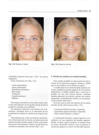Estética facial 29
Fig. 1.14: Niveles en reposo. Fig. 1.15: Niveles en sonrisa.
uniéndolas mediante líneas que "traza" de manera
imaginaria.
Estas estructuras son: (Fig. 1.14)
- Arcos superciliares
- Línea interpupilar
- Pabellones auriculares
- Base nasal.
- Comisuras
- Ángulos goníacos
- Mentón
Para mayor precisión en esta observación resul-
ta muy útil disponer de fotografías donde las líneas
podrán ser trazadas con exactitud.
En pacientes simétricos estas líneas son hori-
zontales y paralelas entre sí; la alteración de ese
paralelismo es indicio de asimetría de origen verti-
cal.
Recordamos que, como en todas las asimetrías,
en la observación de los niveles se deberá partir de
obtener un plano medio sagital vertical para poder
interpretar correctamente cuáles y en qué forma se
encuentran alterados estos niveles (Fig. 1.16).
6- Niveles (en sonrisa y en sonrisa forzada)
Este estudio posibilita la observación de altera-
ciones de las porciones gingival, dentaria y labial
que no son visibles con los labios en reposo.
La utilización de la sonrisa forzada muestra con
mayor claridad la porción gingival de los sectores
posteriores y el plano oclusal, que a veces no es
posible ver con una sonrisa natural. Además,
muchos pacientes no pueden realizar una sonrisa
espontánea, probablemente debido a la circunstan-
cia de sentirse observados.
En estos casos es muy útil valemos de la sonrisa
forzada, donde observaremos (Fig. 1.15):
- Comisuras labiales derecha e izquierda
- Exposición gingival derecha e izquierda
- Plano oclusal superior e inferior
La inclinación del plano oclusal superior es un
indicativo de una asimetría del maxilar superior.
Donde el plano oclusal asciende, el maxilar tiene
un menor desarrollo vertical y por lo general, la
exposición gingival es menor a la del lado opuesto.
 