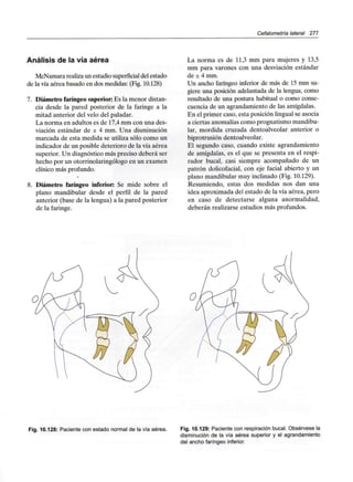Cefalometría lateral 277
Análisis de la vía aérea
McNamara realiza un estudio superficial del estado
de la vía aérea basado en dos medidas: (Fig. 10.128)
7. Diámetro faríngeo superior: Es la menor distan-
cia desde la pared posterior de la faringe a la
mitad anterior del velo del paladar.
La norma en adultos es de 17,4 mm con una des-
viación estándar de ± 4 mm. Una disminución
marcada de esta medida se utiliza sólo como un
indicador de un posible deterioro de la vía aérea
superior. Un diagnóstico más preciso deberá ser
hecho por un otorrinolaringólogo en un examen
clínico más profundo.
8. Diámetro faríngeo inferior: Se mide sobre el
plano mandibular desde el perfil de la pared
anterior (base de la lengua) a la pared posterior
de la faringe.
La norma es de 11,3 mm para mujeres y 13,5
mm para varones con una desviación estándar
de ± 4 mm.
Un ancho faríngeo inferior de más de 15 mm su-
giere una posición adelantada de la lengua, como
resultado de una postura habitual o como conse-
cuencia de un agrandamiento de las amígdalas.
En el primer caso, esta posición lingual se asocia
a ciertas anomalías como prognatismo mandibu-
lar, mordida cruzada dentoalveolar anterior o
biprotrusión dentoalveolar.
El segundo caso, cuando existe agrandamiento
de amígdalas, es el que se presenta en el respi-
rador bucal, casi siempre acompañado de un
patrón dolicofacial, con eje facial abierto y un
plano mandibular muy inclinado (Fig. 10.129).
Resumiendo, estas dos medidas nos dan una
idea aproximada del estado de la vía aérea, pero
en caso de detectarse alguna anormalidad,
deberán realizarse estudios más profundos.
Fig. 10.128: Paciente con estado normal de la vía aérea. Fig. 10.129: Paciente con respiración bucal. Obsérvese la
disminución de la vía aérea superior y el agrandamiento
del ancho faríngeo inferior.
 