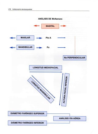 278 Cefalometría dentoesqueletal
ANÁLISIS DE McNamara
SAGITAL
MAXILAR
MANDIBULAR
PtoA
Po
Na PERPENDICULAR
LONGITUD MEDIOFACIAL
DIÁMETRO FARÍNGEO SUPERIOR
DIÁMETRO FARÍNGEO INFERIOR
ANÁLISIS VÍA AÉREA
 