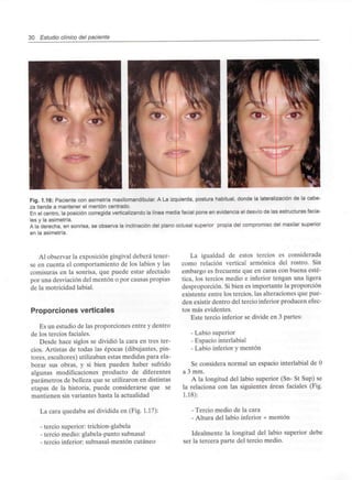 30 Estudio clínico del paciente
Fig. 1.16: Paciente con asimetría maxilomandibular. A La izquierda, postura habitual, donde la lateralización de la cabe-
za tiende a mantener el mentón centrado.
En el centro, la posición corregida verticalizando la línea media facial pone en evidencia el desvío de las estructuras facia-
les y la asimetría.
A la derecha, en sonrisa, se observa la inclinación del plano oclusal superior propia del compromiso del maxilar superior
en la asimetría.
Al observar la exposición gingivaldeberá tener-
se en cuenta el comportamiento de los labios y las
comisuras en la sonrisa, que puede estar afectado
por una desviación del mentón o por causas propias
de la motricidad labial.
Proporciones verticales
Es un estudio de las proporciones entre y dentro
de los tercios faciales.
Desde hace siglos se dividió la cara en tres ter-
cios. Artistas de todas las épocas (dibujantes, pin-
tores, escultores) utilizaban estas medidas para ela-
borar sus obras, y si bien pueden haber sufrido
algunas modificaciones producto de diferentes
parámetros de belleza que se utilizaron en distintas
etapas de la historia, puede considerarse que se
mantienen sin variantes hasta la actualidad
La cara quedaba así dividida en (Fig. 1.17):
- tercio superior: trichion-glabela
- tercio medio: glabela-punto subnasal
- tercio inferior: subnasal-mentón cutáneo
La igualdad de estos tercios es considerada
como relación vertical armónica del rostro. Sin
embargo es frecuente que en caras con buena esté-
tica, los tercios medio e inferior tengan una ligera
desproporción. Si bien es importante la proporción
existente entre los tercios, las alteraciones que pue-
den existir dentro del tercio inferior producen efec-
tos más evidentes.
Este tercio inferior se divide en 3 partes:
- Labio superior
- Espacio interlabial
- Labio inferior y mentón
Se considera normal un espacio interlabial deO
a 3 mm.
A la longitud del labio superior (Sn- St Sup) se
la relaciona con las siguientes áreas faciales (Fig.
1.18):
- Tercio medio de la cara
- Altura del labio inferior + mentón
Idealmente la longitud del labio superior debe
ser la tercera parte del tercio medio.
 