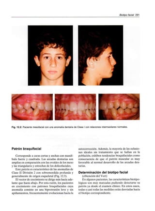 Biotipo facial 291
Fig. 12.2: Paciente mesofacial con una anomalía dentaria de Clase I con relaciones intermaxilaresnormales.
Patrón braquifacial
Corresponde a caras cortas y anchas con mandí-
bula fuerte y cuadrada. Las arcadas dentarias son
amplias en comparación con las ovoides de los meso
y las triangulares y estrechas de los dolicofaciales.
Este patrón es característico de las anomalías de
Clase II División 2 con sobremordida profunda y
generalmente de origen esqueletal (Fig. 12.3).
El vector de crecimiento se dirige más hacia ade-
lante que hacia abajo. Por esta razón, los pacientes
en crecimiento con patrones braquifaciales cuya
anomalía consiste en una biprotrusión leve y sin
apiñamientos, frecuentemente evolucionan hacia la
autocorrección. Además, la mayoría de las oclusio-
nes ideales sin tratamiento que se hallan en la
población, exhiben tendencias braquifaciales como
consecuencia de que el patrón muscular es muy
favorable al normal desarrollo de las arcadas den-
tarias.
Determinación del biotipo facial
(obtención del Vert)
En algunos pacientes, las características biotipo-
lógicas son muy marcadas pudiendo detectarse su
patrón ya desde el examen clínico. En estos casos,
todas o casi todas las medidas están desviadas hacia
el biotipo correspondiente.
 