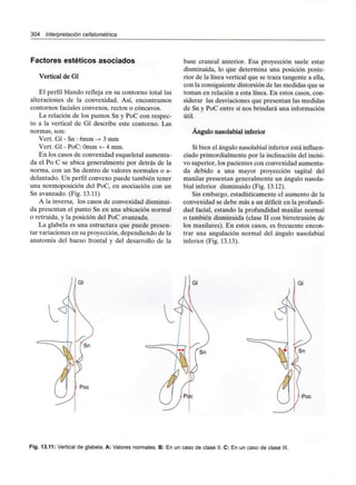 304 Interpretación cefalométrica
Factores estéticos asociados
Vertical de Gl
El perfil blando refleja en su contorno total las
alteraciones de la convexidad. Así, encontramos
contornos faciales convexos, rectos o cóncavos.
La relación de los puntos Sn y PoC con respec-
to a la vertical de Gl describe este contorno. Las
normas, son:
Vert. Gl - Sn : 6mm -+ 3 mm
Vert. Gl - PoC: Omm +- 4 mm.
En los casos de convexidad esqueletal aumenta-
da el Po C se ubica generalmente por detrás de la
norma, con un Sn dentro de valores normales o a-
delantado. Un perfil convexo puede también tener
una normoposición del PoC, en asociación con un
Sn avanzado. (Fig. 13.11)
A la inversa, los casos de convexidad disminui-
da presentan el punto Sn en una ubicación normal
o retruida, y la posición del PoC avanzada.
La glabela es una estructura que puede presen-
tar variaciones en su proyección, dependiendo de la
anatomía del hueso frontal y del desarrollo de la
base craneal anterior. Esa proyección suele estar
disminuida, lo que determina una posición poste-
rior de la línea vertical que se traza tangente a ella,
con la consiguiente distorsión de las medidas que se
toman en relación a esta línea. En estos casos, con-
siderar las desviaciones que presentan las medidas
de Sn y PoC entre sí nos brindará una información
útil.
Ángulo nasolabial inferior
Si bien el ángulo nasolabial inferior está influen-
ciado primordialmente por la inclinación del incisi-
vo superior, los pacientes con convexidad aumenta-
da debido a una mayor proyección sagital del
maxilar presentan generalmente un ángulo nasola-
bial inferior disminuido (Fig. 13.12).
Sin embargo, estadísticamente el aumento de la
convexidad se debe más a un déficit en la profundi-
dad facial, estando la profundidad maxilar normal
o también disminuida (clase II con birretrusión de
los maxilares).En estos casos, es frecuente encon-
trar una angulación normal del ángulo nasolabial
inferior (Fig. 13.13).
Gl Gl
Poc
Poc
Fig. 13.11: Vertical de glabela. A: Valores normales. B: En un caso de clase II. C: En un caso de clase
 