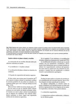 318 Interpretación cefalométrica
Fig 13.30: Medida del incisivo inferior con respecto al plano oclusal. En ambos casos de sobremordida está aumentada.
En A, observamos un plano oclusal más bajo en el sector anterior, evidenciado por su relación con la comisura. En este
caso, esta medida no tiene validez, porque no habrá que planificar una intrusión de los incisivos inferiores sino de los
superiores, para lograr una buena exposición de estos dientes.
El caso B presenta una posición normal del plano oclusal con respecto a la comisura, por lo que es correcto planificar
la intrusión del incisivo inferior.
Incisivo inferior al plano oclusal y overbite
La corrección de un overbite alterado debe pla-
nificarse teniendo en cuenta:
• La medida de +1 al plano oclusal.
• La ubicación del plano oclusal en relación a la
comisura.
• El grado de exposición del incisivo superior.
Si bien existe una norma para la posición del 1
con respecto al plano oclusal, es necesario verificar
la correcta posición de este plano en relación a la
comisura labial, que es de 3 mm por debajo de ésta
(Fig. 13.30).
Sólo así tiene validez la norma citada para el 1.
En los casos en que la relación plano oclusal-
comisura no esté dentro de límites normales, debe-
rá trazarse un nuevo plano oclusal (normalizado)
con el objetivo de establecer una relación labio-
diente armónica, es decir, lograr una exposición
estética de los incisivos superiores.
En el capítulo 17 nos referimos a lamodificación
del planooclusalen el momento del trazadodel VTO.
La modificación del plano oclusal que se puede
realizar con un tratamiento ortodóncico, obvia-
mente tiene limitaciones que no siempre podrán sa-
tisfacer los requerimientos estéticos del paciente.
En estos casos se optará por una solución de com-
promiso y cuando ésta sea insuficiente, se deberá
recurrir a procedimientos quirúrgicos.
Clase molar
Evaluar la clase molar es el punto de partida pa-
ra la planificaciónde la arcada superior, que se rea-
liza después de haber planificado la inferior.
En algunas radiografías, la relación molar no
puede visualizarsecon claridad porque no existe una
perfecta superposición de las imágenes de los mola-
res izquierdos y derechos. Esto puede deberse:
• a asimetrías esqueletales,
• a migraciones molares unilaterales, obilatera-
les de distinto grado.
 