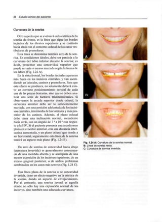 34 Estudio clínico del paciente
Curvatura de la sonrisa
Otro aspecto que se evaluará en la estética de la
sonrisa de frente, es la línea que sigue los bordes
incisales de los dientes superiores y se continúa
hacia atrás con el contorno oclusal de las caras ves-
tibulares de premolares.
Esta línea se denomina también arco de la son-
risa. En condiciones ideales, debe ser paralela a la
curvatura del labio inferior durante la sonrisa; es
decir, presentar una concavidad superior que
puede ser más o menos marcada según la forma de
los labios (Fig. 1.24 A).
En la vista frontal, los bordes incisales aparecen
más bajos en los incisivos centrales, y van ascen-
diendo en laterales, caninos y premolares. Para que
este efecto se produzca, no solamente deberá exis-
tir un correcto posicionamiento vertical de cada
una de las piezas dentarias, sino que se deben ana-
lizar una serie de factores tridimensionales. Si
observamos la arcada superior desde oclusal. la
curvatura anterior debe ser lo suficientemente
marcada, con una posición adelantada de losincisi-
vos centrales, intermedia de los laterales y más pos-
terior de los caninos. Además, el plano oclusal
debe tener una inclinación normal, ascendente
hacia atrás, con un ángulo de 7 ° a 10 ° con respec-
to a la HV. Si el paciente presenta una arcada muy
plana en el sector anterior, con una distancia inter-
canina aumentada, y un plano oclusal que tiende a
ser horizontal, seguramente esta línea de la sonrisa
tendrá un aspecto más plano (Fig. 1.24 B).
Un arco de sonrisa de concavidad hacia abajo
(curvatura invertida) es generalmente consecuen-
cia de una mordida abierta y se acompaña de una
menor exposición de los incisivos superiores, de un
exceso gingival posterior, o de ambos problemas
combinados en los casos más severos (Fig. 1.24 C).
Una línea plana de la sonrisa o de concavidad
invertida, tiene un efecto negativo en la estética de
la sonrisa, dando un aspecto de envejecimiento.
Por el contrario, una sonrisa juvenil es aquella
donde no sólo hay una exposición normal de los
incisivos, sino también una adecuada curvatura.
Fig. 1.24 A: Curvatura de la sonrisanormal.
B: Línea de sonrisarecta.
C: Curvatura de sonrisa invertida.
 