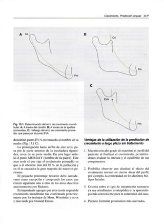 Crecimiento. Predicción arquial 341C
B
Pm
Fig. 15.1: Determinación del arco de crecimientomandi-
bular. A: A través del cóndilo. B: A través de la apófisis
coronoides. C: Hallazgo del arco de crecimiento prome-
dio, que pasa por el punto EVA.
denominó punto EVA en recuerdo al nombre de su
madre (Fig. 15.1 C).
La prolongación hacia arriba de este arco, pa-
sa por la parte anterior de la escotadura sigmoi-
dea, cerca de su parte media. En este lugar seña-
ló el punto MURRAY (nombre de su padre). Este
arco sería el que rige el crecimiento promedio ya
que a él obedece más del 85 % de la población y
en él se encuadra la gran mayoría de nuestros pa-
cientes.
El pequeño porcentaje restante debe conside-
rarse como excepción y comprende los casos que
crecen siguiendo uno u otro de los arcos descritos
anteriormente por Ricketts.
Es importante agregar que esta teoría arquial de
crecimiento mandibular fue confirmada posterior-
mente por los trabajos de Moss, Woodside y otros
y más tarde por Donald Enlow.
Ventajas de la utilización de la predicción de
crecimiento a largo plazo sin tratamiento
1. Muestra con alto grado de exactitud el perfil del
paciente al finalizar el crecimiento, permitién-
donos evaluar la estética y el equilibrio de sus
componentes.
2. Posibilita observar con claridad el efecto del
crecimiento normal en ciertas áreas del perfil;
por ejemplo, la convexidad en los distintos bio-
tipos faciales.
3. Orienta sobre el tipo de tratamiento necesario
ya sea ortodóncico u ortopédico y la aparatolo-
gía más conveniente para la corrección del caso.
4. Permite formular pronósticos más acertados.
 