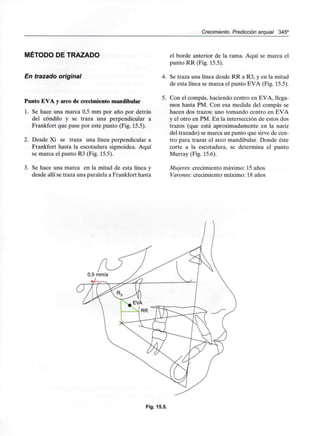 Crecimiento. Predicción arquial 345°
MÉTODO DE TRAZADO
En trazado original
Punto EVA y arco de crecimiento mandibular
1. Se hace una marca 0,5 mm por año por detrás
del cóndilo y se traza una perpendicular a
Frankfort que pase por este punto (Fig. 15.5).
2. Desde Xi se traza una línea perpendicular a
Frankfort hasta la escotadura sigmoidea. Aquí
se marca el punto R3 (Fig. 15.5).
3. Se hace una marca en la mitad de esta línea y
desde allí se traza una paralela a Frankfort hasta
el borde anterior de la rama. Aquí se marca el
punto RR (Fig. 15.5).
4. Se traza una línea desde RR a R3, y en la mitad
de esta línea se marca el punto EVA (Fig. 15.5).
5. Con el compás, haciendo centro en EVA, llega-
mos hasta PM. Con esa medida del compás se
hacen dos trazos: uno tomando centro en EVA
y el otro en PM. En la intersección de estos dos
trazos (que está aproximadamente en la nariz
del trazado) se marca un punto que sirve de cen-
tro para trazar el arco mandibular. Donde éste
corte a la escotadura, se determina el punto
Murray (Fig. 15.6).
Mujeres: crecimiento máximo: 15 años
Varones: crecimiento máximo: 18 años
Fig. 15.5.
 