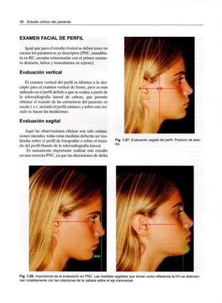 36 Estudio clínico del paciente
EXAMEN FACIAL DE PERFIL
Igual que para el estudio frontal se deben tener en
cuenta los parámetros ya descriptos (PNC, mandíbu-
la en RC, arcadas relacionadas con el primer contac-
to dentario, labios y musculatura en reposo).
Evaluación vertical
El examen vertical del perfil es idéntico a lo des-
cripto para el examen vertical de frente, pero es más
utilizado en el perfil debido a que se realiza a partir de
la telerradiografía lateral de cabeza, que permite
obtener el trazado de las estructuras del paciente en
escala 1a 1,incluido el perfil cutáneo, y sobre este tra-
zado se hacen las mediciones.
Evaluación sagital
Aquí las observaciones clínicas son sólo estima-
ciones iniciales, todas estas medidas deberán ser rea-
lizadas sobre el perfil de fotografías o sobre el traza-
do del perfil blando de la telerradiografía lateral.
Es sumamente importante realizar este estudio
en una correcta PNC, ya que las alteraciones de dicha
Fig. 1.27: Evaluación sagital del perfil. Posición de estu-
dio.
Fig. 1.28: Importancia de la evaluación en PNC. Las medidas sagitales que toman como referencia la HV se distorsio-
nan notablemente con las rotaciones de la cabeza sobre el eje transversal.
 