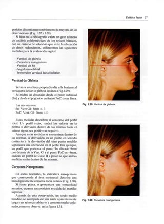 Estética facial 37
posición distorsionan notablemente la mayoría de las
observaciones (Fig. 1.27 y 1.28).
Si bien en la bibliografía existe un gran número
de análisis cefalométricos de los tejidos blandos,
con un criterio de selección que evite la obtención
de datos redundantes, utilizaremos las siguientes
medidas para la evaluación sagital:
-Vertical de glabela
-Curvatura nasogeniana
-Vertical de Sn
-Ángulo nasolabial
-Proporción cervical-facial inferior
Vertical de Glabela
Se traza una línea perpendicular a la horizontal
verdadera desde la glabela cutánea (Fig.1.29).
Se miden las distancias desde el punto subnasal
(Sn) y desde el pogonion cutáneo (PoC) a esa línea.
Las normas son:
Sn-VertGl: 6mm+-3
PoC- Vert. Gl: Omm +-4
Estas medidas describen el contorno del perfil
total. Un perfil recto, tendrá los valores en la
norma o desviados dentro de las mismas hacia el
mismo signo, sea positivo o negativo.
Aunque estas medidas se encuentren dentro de
las normas, la desviación en un punto en sentido
contrario a la desviación del otro punto medido
significará una alteración en el perfil. Por ejemplo,
un perfil que presenta el punto Sn ubicado 9mm
por delante de la Vert. Gl y el punto PoC en -4mm,
indican un perfil de Clase II a pesar de que ambas
medidas están dentro de las normas.
Curvatura Nasogeniana
En caras normales, la curvatura nasogeniana
que corresponde al área paranasal, describe una
línea ligeramente convexa hacia delante (Fig. 1.30).
Si fuera plana, o presentara una concavidad
anterior, expresa una posición retruida del maxilar
superior.
Además de esta observación, un tercio medio
hundido se acompaña de una nariz aparentemente
larga y un reborde orbitario y contorno malar apla-
nado, como se observa en la figura 1.31.
Fig. 1.29: Vertical de glabela.
Fig. 1.30: Curvatura nasogeniana.
 