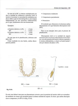 Síntesis del diagnóstico 359
El valor de la DC, se obtiene multiplicando por
dos la cantidad de milímetros existentes entre el
incisivo y la norma. La necesidad de multiplicar por
dos se debe a que la telerradiografía es una imagen
bidimensional, de una estructura tridimensional,
por lo que visualizamos sólo una hemiarcada.
Ejemplos:
a) Incisivo inferior a A-Po = +4 mm
DC = -6 mm
b) Incisivo inferior a A-Po = Omm
DC = +2 mm
En este paso de la planificación, debemos unir
DD y DC.
Como resultado de esta fusión, ambas discre-
pancias podrán:
• Compensarse totalmente
• Compensarse parcialmente
• Potenciarse
El resultado que obtenemos al relacionar ambas
discrepancias es lo que llamamos discrepancia total
(DT).
Éste es un concepto clave para el proceso de
planificación.
Discrepancia total es la cantidad de espacio
necesario para el correcto alineamiento de los dien-
tes, con una posición del incisivo inferior ajustada a
la norma cefalométrica, es decir su borde incisal 1
mm por delante del plano A-Po.
A-Po
1 al A-Po = - 2 mm
DD = - 6 mm DC = + 6 mm
Fig. 16.10.
DT = 0
En este caso faltan 6 mm para un alineamiento correcto, pero la posición del incisivo debe ser normaliza-
da mediante un avance que permitirá ganar la misma cantidad de espacio. Es decir, que ambas discrepan-
cias se compensan y la DT es O(Fig. 16.10).
 