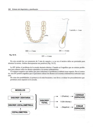 362 Síntesis del diagnóstico y planificación
1 al A-Po = - 1 mm
DD = + 2 mm DC = + 4mm
Fig. 16.15.
DT = + 6 mm
En esta arcada hay un remanente de 2 mm de espacio, y a su vez el incisivo debe ser protruido para
alcanzar la norma. Ambas discrepancias son positivas (Fig. 16.15).
La DT define el problema de la arcada dentaria inferior. Cuando es Osignifica que no existen proble-
mas para alinear todos los dientes ajustados a la norma cefalométrica.
Un número negativo nos indica que para solucionar el problema se deberá crear espacio. Por el contra-
rio, una DT positiva significa que si queremos colocar los dientes en la norma cefalométrica sobrarán espa-
cios.
De estas dos posibilidades, la primera es la más frecuente y nos lleva a evaluar los procedimientos que
permitan crear espacios en la arcada.
MODELOS
DISCREP. DENTARIA
DISCREP. CEFALOMÉTRICA
CEFALOMETRÍA
DISCREP.
TOTAL
+ (Positiva)
O (Sin discrep.)
- (Negativa)—
 