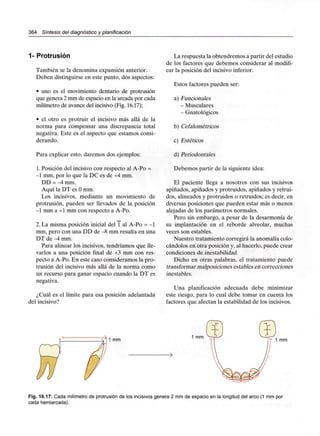 364 Síntesis del diagnóstico y planificación
1- Protrusión
También se la denomina expansión anterior.
Deben distinguirse en este punto, dos aspectos:
• uno es el movimiento dentario de protrusión
que genera 2 mm de espacio en la arcada por cada
milímetro de avance del incisivo (Fig. 16.17);
• el otro es protruir el incisivo más allá de la
norma para compensar una discrepancia total
negativa. Este es el aspecto que estamos consi-
derando.
Para explicar esto, daremos dos ejemplos:
1.Posición del incisivo con respecto al A-Po =
-1 mm, por lo que la DC es de +4mm.
DD = -4 mm.
Aquí la DT es O mm.
Los incisivos, mediante un movimiento de
protrusión, pueden ser llevados de la posición
-1 mm a +1 mm con respecto a A-Po.
2. La misma posición inicial del 1 al A-Po = -1
mm, pero con una DD de -8 mm resulta en una
DT de -4 mm.
Para alinear los incisivos, tendríamos que lle-
varlos a una posición final de +3 mm con res-
pecto a A-Po. En este caso consideramos la pro-
trusión del incisivo más allá de la norma como
un recurso para ganar espacio cuando la DT es
negativa.
¿Cuál es el límite para esa posición adelantada
del incisivo?
La respuesta la obtendremos a partir del estudio
de los factores que debemos considerar al modifi-
car la posición del incisivoinferior.
Estos factores pueden ser:
a) Funcionales
- Musculares
- Gnatológicos
b) Cefalométrícos
c) Estéticos
d) Periodontales
Debemos partir de la siguiente idea:
El paciente llega a nosotros con sus incisivos
apiñados, apiñados y protruidos, apiñados y retrui-
dos, alineados y protruidos o retruidos; es decir, en
diversas posiciones que pueden estar más o menos
alejadas de los parámetros normales.
Pero sin embargo, a pesar de la desarmonía de
su implantación en el reborde alveolar, muchas
veces son estables.
Nuestro tratamiento corregirá la anomalía colo-
cándolos en otra posición y, al hacerlo, puede crear
condiciones de inestabilidad.
Dicho en otras palabras, el tratamiento puede
transformar malposiciones estables en correcciones
inestables.
Una planificación adecuada debe minimizar
este riesgo, para lo cual debe tomar en cuenta los
factores que afectan la estabilidad de losincisivos.
1 mm 1 mm
T 1 mm
Fig. 16.17: Cada milímetro de protrusiónde los incisivosgenera 2 mm de espacio en la longitud del arco (1 mm por
cada hemiarcada).
 