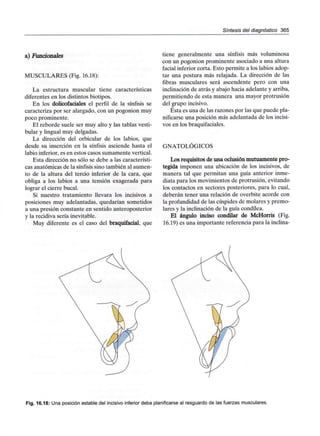 Síntesis del diagnóstico 365
a) Funcionales
MUSCULARES (Fig. 16.18):
La estructura muscular tiene características
diferentes en los distintos biotipos.
En los dolicofaciales el perfil de la sínfisis se
caracteriza por ser alargado, con un pogonion muy
poco prominente.
El reborde suele ser muy alto y las tablas vesti-
bular y lingual muy delgadas.
La dirección del orbicular de los labios, que
desde su inserción en la sínfisis asciende hasta el
labio inferior, es en estos casos sumamente vertical.
Esta dirección no sólo se debe a las característi-
cas anatómicas de la sínfisis sino también al aumen-
to de la altura del tercio inferior de la cara, que
obliga a los labios a una tensión exagerada para
lograr el cierre bucal.
Si nuestro tratamiento llevara los incisivos a
posiciones muy adelantadas, quedarían sometidos
a una presión constante en sentido anteroposterior
y la recidiva sería inevitable.
Muy diferente es el caso del braquifacial, que
tiene generalmente una sínfisis más voluminosa
con un pogonion prominente asociado a una altura
facial inferior corta. Esto permite a los labios adop-
tar una postura más relajada. La dirección de las
fibras musculares será ascendente pero con una
inclinación de atrás y abajo hacia adelante y arriba,
permitiendo de esta manera una mayor protrusión
del grupo incisivo.
Ésta es una de las razones por las que puede pla-
nificarse una posición más adelantada de los incisi-
vos en los braquifaciales.
GNATOLÓGICOS
Los requisitos de una oclusión mutuamente pro-
tegida imponen una ubicación de los incisivos, de
manera tal que permitan una guía anterior inme-
diata para los movimientos de protrusión, evitando
los contactos en sectores posteriores, para lo cual,
deberán tener una relación de overbite acorde con
la profundidad de las cúspides de molares y premo-
lares y la inclinación de la guía condílea.
El ángulo inciso condilar de McHorris (Fig.
16.19) es una importante referencia para la inclina-
Fig. 16.18: Una posición estable del incisivo inferior deba planificarse al resguardo de las fuerzas musculares.
 