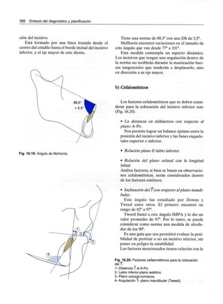 366 Síntesis del diagnóstico y planificación
ción del incisivo.
Está formado por una línea trazada desde el
centro del cóndilo hasta el borde incisal del incisivo
inferior, y el eje mayor de este diente.
Fig. 16.19: Ángulo de McHorris.
Tiene una norma de 88,5° con una DS de 5,5°.
McHorris encontró variaciones en el tamaño de
este ángulo que van desde 77° a 101°.
Esta medida contempla un aspecto dinámico.
Los incisivos que tengan una angulación dentro de
la norma no recibirán durante la masticación fuer-
zas tangenciales que tenderán a desplazarlo, sino
en dirección a su eje mayor.
b) Cefalométricos
Los factores cefalométricos que se deben consi-
derar para la colocación del incisivo inferior son:
(Fig. 16.20)
• La distancia en milímetros con respecto al
plano A-Po.
Nos permite lograr un balance óptimo entre la
posición del incisivo inferior y las bases esquele-
tales superior e inferior.
• Relación plano E-labio inferior.
• Relación del plano oclusal con la longitud
labial.
Ambos factores, si bien se basan en observacio-
nes cefalométricas, serán considerados dentro
de los factores estéticos.
• Inclinación del 1 con respecto alplano mandi-
bular.
Este ángulo fue estudiado por Downs y
Tweed entre otros. El primero encontró un
rango de 82° a 97°.
Tweed llamó a este ángulo IMPA y le dio un
valor promedio de 87°. Por lo tanto, se puede
considerar como norma una medida de alrede-
dor de los 90°.
Es una guía que nos permitirá evaluar la posi-
bilidad de protruir o no un incisivo inferior, sin
poner en peligro la estabilidad.
Los factores mencionados tienen relación con la
Fig.J6.20: Factores cefalométricos para lacolocación
deM.
1- Distancia 1 al A-Po.
2- Labio inferior-plano estético.
3- Plano oclusal-comisura.
4-Angulación 1- plano mandibular (Tweed).
 