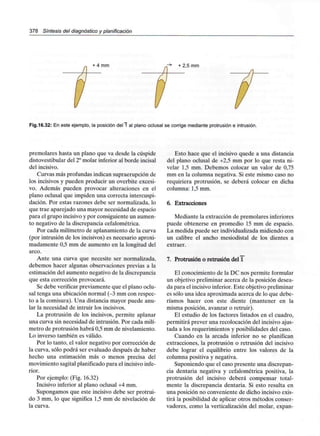 378 Síntesis del diagnóstico y planificación
+ 4 mm + 2,5 mm
Fig.16.32: En este ejemplo, la posición del 1 al plano oclusal se corrige mediante protrusión e intrusión.
premolares hasta un plano que va desde la cúspide
distovestibular del 2°molar inferior al borde incisal
del incisivo.
Curvas más profundas indican supraerupción de
los incisivos y pueden producir un overbite excesi-
vo. Además pueden provocar alteraciones en el
plano oclusal que impiden una correcta intercuspi-
dación. Por estas razones debe ser normalizada, lo
que trae aparejado una mayor necesidad de espacio
para el grupo incisivo y por consiguiente un aumen-
to negativo de la discrepanciacefalométrica.
Por cada milímetro de aplanamiento de la curva
(por intrusión de los incisivos) es necesario aproxi-
madamente 0,5 mm de aumento en la longitud del
arco.
Ante una curva que necesite ser normalizada,
debemos hacer algunas observaciones previas a la
estimación del aumento negativode ladiscrepancia
que esta corrección provocará.
Se debe verificar previamente que el plano oclu-
sal tenga una ubicación normal (-3 mm con respec-
to a la comisura). Una distancia mayor puede anu-
lar la necesidad de intruir los incisivos.
La protrusión de los incisivos, permite aplanar
una curva sin necesidad de intrusión. Por cada milí-
metro de protrusión habrá 0,5mm de nivelamiento.
Lo inverso también es válido.
Por lo tanto, el valor negativo por corrección de
la curva, sólo podrá ser evaluado después de haber
hecho una estimación más o menos precisa del
movimiento sagital planificadopara el incisivo infe-
rior.
Por ejemplo: (Fig. 16.32)
Incisivo inferior al plano oclusal +4 mm.
Supongamos que este incisivo debe ser protrui-
do 3 mm, lo que significa 1,5 mm de nivelación de
la curva.
Esto hace que el incisivo quede a una distancia
del plano oclusal de +2,5 mm por lo que resta ni-
velar 1,5 mm. Debemos colocar un valor de 0,75
mm en la columna negativa. Si este mismo caso no
requiriera protrusión, se deberá colocar en dicha
columna: 1,5 mm.
6. Extracciones
Mediante la extracción de premolaresinferiores
puede obtenerse en promedio 15 mm de espacio.
La medida puede ser individualizada midiendo con
un calibre el ancho mesiodistal de los dientes a
extraer.
7. Protrusión o retrusión del1
El conocimiento de la DC nos permite formular
un objetivo preliminar acerca de la posición desea-
da para el incisivoinferior. Este objetivo preliminar
es sólo una idea aproximada acerca de lo que debe-
ríamos hacer con este diente (mantener en la
misma posición, avanzar o retruir).
El estudio de los factores listados en el cuadro,
permitirá prever una recolocación del incisivo ajus-
tada a los requerimientos y posibilidades del caso.
Cuando en la arcada inferior no se planifican
extracciones, la protrusión o retrusión del incisivo
debe lograr el equilibrio entre los valores de la
columna positiva y negativa.
Suponiendo que el caso presente una discrepan-
cia dentaria negativa y cefalométrica positiva, la
protrusión del incisivo deberá compensar total-
mente la discrepancia dentaria. Si esto resulta en
una posición no conveniente de dicho incisivo exis-
tirá la posibilidad de aplicar otros métodos conser-
vadores, como la verticalización del molar, expan-
 