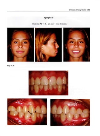 Síntesis del diagnóstico 383
Fig. 16.36
Ejemplo II:
Paciente: M. V. B. - 20 años - Sexo femenino
 