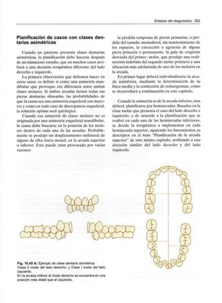 Síntesis del diagnóstico 393
Planificación de casos con clases den-
tarias asimétricas
Cuando un paciente presenta clases dentarias
asimétricas, la planificación debe hacerse después
de un minucioso estudio, que en muchos casos arri-
bará a una decisión terapéutica diferente del lado
derecho e izquierdo.
La primera observación que debemos hacer en
estos casos, es definir si existe una asimetría man-
dibular que provoque esa diferencia entre ambas
clases molares. Si ambas arcadas tienen todas sus
piezas dentarias alineadas, las probabilidades de
que la causa sea una asimetría esqueletal son mayo-
res y como en todo caso de discrepancia esqueletal,
la solución óptima será quirúrgica.
Cuando esa asimetría de clases molares no es
originada por una asimetría esqueletal mandibular,
la causa debe buscarse en la posición de los mola-
res dentro de cada una de las arcadas. Probable-
mente se produjo un desplazamiento unilateral de
alguno de ellos hacia mesial, en la arcada superior
o inferior. Esto puede estar provocado por varias
razones:
la pérdida temprana de piezas primarias, o pér-
dida del tamaño mesiodistal, sin mantenimiento de
los espacios, la extracción o agenesia de alguna
pieza primaria o permanente, la guía de erupción
desviada del primer, molar, que produjo una reab-
sorción indebida del segundo molar primario y una
ubicación más adelantada de uno de los molares en
la arcada.
En primer lugar deberá individualizarsela arca-
da asimétrica, mediante la determinación de su
línea media y la confección de oclusogramas, como
se desarrollará a continuación en este capítulo.
Cuando la asimetría es de la arcada inferior, ésta
deberá planificarsepor hemiarcadas. Basados en la
clase molar que presenta el caso del lado derecho e
izquierdo, y de acuerdo a la planificación que se
realizó en cada una de las hemiarcadas inferiores,
se decide la terapéutica a implementar en cada
hemiarcada superior, siguiendo los lineamientos ya
descriptos en el ítem "Planificación de la arcada
superior" de este mismo capítulo, arribando a una
decisión similar del lado derecho y del lado
izquierdo.
Fig. 16.45 A: Ejemplo de clase dentaria asimétrica.
Clase II molar del lado derecho; y Clase I molar del lado
izquierdo.
En la arcada inferior el molar derechose encuentraen una
posición más distal que el izquierdo.
 