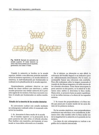 394 Síntesis del diagnóstico y planificación
Fig. 16.45 B: Ejemplo de asimetría de
arcada superior. El molar derecho se
ubica más hacia mesial que el izquierdo,
generando una Clase II molar.
Cuando la asimetría se localiza en la arcada
superior, debido a una diferente posición mesiodis-
tal de los molares superiores, y la arcada inferior es
simétrica, la individualización por hemiarcadas se
realizará en la planificación de la arcada superior.
Ocasionalmente, podemos observar un caso
donde las clases molares son simétricas y ambas
arcadas presentan una similar asimetría de la posi-
ción sagital de los molares. Esto hace necesario rea-
lizar el estudio por hemiarcadas en ambos maxila-
res.
Estudio de la simetría de las arcadas dentarias
Es conveniente realizar este estudio mediante
un oclusograma realizado sobre el escaneado oclu-
sal de los modelos.
1- Se determina la línea media de la arcada
En el maxilar superior: es la proyección de la
parte posterior del rafe sobre el reborde alveolar.
Para facilitar esta maniobra, previamente al esca-
neado se traza dicha referencia en el modelo.
En el inferior, su obtención es más difícil, la
referencia del frenillo lingual es un indicativo pero
no suficientemente determinante. Por lo tanto, es
aconsejable buscar una referencia más confiable.
Para ello realizamos sobre la imagen escaneada el
trazado de dos líneas tangentes a la tabla interna de
los rebordes alveolares. Estas líneas interceptan la
parte anterior en dos puntos, en la mitad de la dis-
tancia entre ambos se determina la línea media.
Hacia atrás, se proyecta hasta un punto equidistan-
te de las tablas internas a la altura de los segundos
molares.
2- Se trazan dos perpendiculares a la línea me-
dia que pasan por el punto medio de las caras dis-
tales de los primeros molares.
En las arcadas simétricas, estas perpendiculares
constituyen una sola línea; si no coincidieran, la dis-
tancia entre ellas medida sobre la línea media nos
da la magnitud de la asimetría en la posición de los
molares.
Los datos de este oclusograma se vuelcan a un
gráfico de la relación interarcada
 