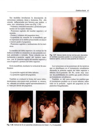 Estética facial 41
Sus medidas involucran la descripción de
estructuras cutáneas, óseas y dentarias. Por ello
estarán influenciadas por factores que atañen a
estas tres estructuras, como son (Fig. 1.39):
- Volumen, tonicidad muscular y posiciones pos-
turales de los tejidos blandos.
- Posiciones sagitales del maxilar superior y el
mentón.
- Forma y volumen del pogonion óseo.
- La posición de rotación de la mandíbula, que
se expresará en la sínfísis proyectando en mayor
o menor grado el pogonion.
- Posiciones sagitales e inclinaciones de los inci-
sivos.
La medida del labio superior a la vertical de Sn
indica si el labio se encuentra en una posición nor-
mal, protruido o retruido. Tiene relación con la
inclinación y posición sagital del incisivo supe-
rior, con la posición sagital del maxilar superior y
con el espesor y postura del labio superior.
En la mandíbula, mediante la vertical de Sn ana-
lizamos:
- La posición sagital del labio inferior.
- La posición sagital del pogonion.
También se evaluará la forma del surco labio-
mentoniano, cuyo punto más profundo se encuen-
tra ubicado en sentido sagital aproximadamente 2
o 3 mm por detrás del pogonion.
Fig. 1.37: Valores dentro de las normas perodesviados
en sentidosopuestos pueden no corresponderse a un
balance óptimo, como en esta paciente de Clase III.
Las variaciones en las posiciones de los incisivos
que se planifiquen en el tratamiento ortodóncico
afectarán la posición sagital del labio superior e
inferior. En la posición del Po, serán muy esca-
sas las posibilidades de cambio que podrá obtener
un tratamiento ortodóncico.
También es útil para evaluar los cambios que
el crecimiento produce en el tercio inferior, sobre
todo en la posición sagital del pogonion en los
pacientes braquifaciales.
Fig. 1.38: Vertical de Sn en pacientes ortodóncicos de Clase I, II y III esqueletal.
 