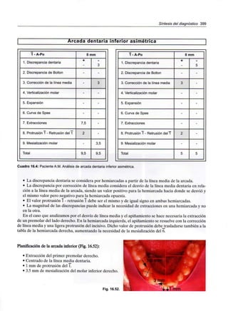 Síntesis del diagnóstico 399
Arcada dentaria inferior asimétrica
1 - A-Po
1. Discrepancia dentaria
2. Discrepancia de Bolton
3. Corrección de la línea media
4. Verticalización molar
5. Expansión
6. Curva de Spee
7. Extracciones
8. Protrusión 1 - Retrusión del 1
9. Mesialización molar
Total
0 mm
+
-
-
-
-
-
7,5
2
-
9,5
3
-
3
-
-
-
-
-
3,5
9,5
1 - A-Po
1. Discrepancia dentaria
2. Discrepancia de Bolton
3. Corrección de la línea media
4. Verticalización molar
5. Expansión
6. Curva de Spee
7. Extracciones
8. Protrusión 1 - Retrusión del 1
9. Mesialización molar
Total
0 mm
+
-
3
-
-
-
-
2
-
5
5
-
-
-
-
-
-
-
-
5
Cuadro 16.4: Paciente A.M. Análisis de arcada dentaria inferior asimétrica.
• La discrepancia dentaria se considera por hemiarcadas a partir de la línea media de la arcada.
• La discrepancia por corrección de línea media considera el desvío de la línea media dentaria en rela-
ción a la línea media de la arcada, siendo un valor positivo para la hemiarcada hacia donde se desvió y
el mismo valor pero negativo para la hemiarcada opuesta.
• El valor protrusión I - retrusión T debe ser el mismo y de igual signo en ambas hemiarcadas.
• La magnitud de las discrepancias puede indicar la necesidad de extracciones en una hemiarcada y no
en la otra.
En el caso que analizamos por el desvío de línea media y el apiñamiento se hace necesaria la extracción
de un premolar del lado derecho. En la hemiarcada izquierda, el apiñamiento se resuelve con la corrección
de línea media y una ligera protrusión del incisivo. Dicho valor de protrusión debe trasladarse también a la
tabla de la hemiarcada derecha, aumentando la necesidad de la mesialización del 6.
Planificación de la arcada inferior (Fig. 16.52):
• Extracción del primer premolar derecho.
• Centrado de la línea media dentaria.
• 1mm de protrusión del 1.
• 3.5mm de mesialización del molar inferior derecho.
Fig. 16.52.
3 mm
mm
 