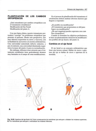 Síntesis del diagnóstico 407
PLANIFICACIÓN DE LOS CAMBIOS
ORTOPÉDICOS
¿Qué entendemos por cambios ortopédicos con
el tratamiento ortodóncico?
Modificación del Eje Facial
Modificación del punto A
Con una lógica clínica, nuestro tratamiento pre-
tenderá "corregir" los problemas ortopédicos que
presente el paciente. Desde esta perspectiva, ejes
muy abiertos requerirían su cierre y viceversa, con
la finalidad de acercarnos a la norma cefalométrica.
Una convexidad aumentada debería reducirse, y
por el contrario, una convexidad disminuida reque-
riría el avance del punto A para su normalización.
Sin embargo, debemos tener presente que el tra-
tamiento ortodóncico tiene generalmente alcances
muy limitados en el campo de estas modificaciones.
En el proceso de planificacióndel tratamiento el
ortodoncista deberá analizar diversos factores que
lleguen a responder:
¿Es posible esa modificación?
¿El tratamiento que proponemos es útil para
lograr esa modificación?
¿De qué magnitud pueden esperarse esos cam
bios ortopédicos?
Cuando se formulan los objetivos preliminares,
se hace un planteamiento inicial de lasmodificacio-
nes posibles del eje facial y del punto A.
Cambios en el eje facial
El eje facial es un concepto cefalométrico que
tiene una lectura oclusal. Hablar de cierre o aper-
tura del eje es hablar de cierre o apertura de la
mordida.
B
Fig. 16.62: Apertura del eje facial. A: Como consecuenciade maniobras que extruyeno distalan los molares superiores.
B: Por maniobras que extruyen o verticalizan los molares inferiores.
 