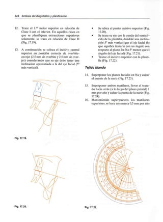 424 Síntesis del diagnóstico y planificación
12. Trace el l.er molar superior en relación de
Clase I con el inferior. En aquellos casos en
que se planifiquen extracciones superiores
solamente, se traza en relación de Clase II
(Fig. 17.19).
13. A continuación se coloca el incisivo central
superior en posición correcta de overbite-
overjet (2,5 mm de overbite y 2,5 mm de over-
jet) considerando que su eje debe tener una
inclinación aproximada a la del eje facial (5°
más vertical).
Fig. 17.19.
• Se ubica el punto incisivo superior (Fig.
17.20).
• Se traza su eje con la ayuda del semicír-
culo de la plantilla, dándole una inclina-
ción 5° más vertical que el eje facial (lo
que significa trazarlo con un ángulo con
respecto al plano Ba-Na 5°menor que el
ángulo del eje facial) (Fig. 17.21).
• Trazar el incisivo superior con la planti-
lla (Fig. 17.22).
Tejido blando
14. Superponer los planos faciales en Na y calcar
el puente de la nariz (Fig. 17.23).
15. Superponer ambos maxilares, llevar el traza-
do hacia atrás (a lo largo del plano palatal) 1
mm por año y calcar la punta de la nariz (Fig.
17.24).
16. Manteniendo superpuestos los maxilares
superiores, se hace una marca 0,5 mm por año
Fig. 17.20. Fig. 17.21.
 
